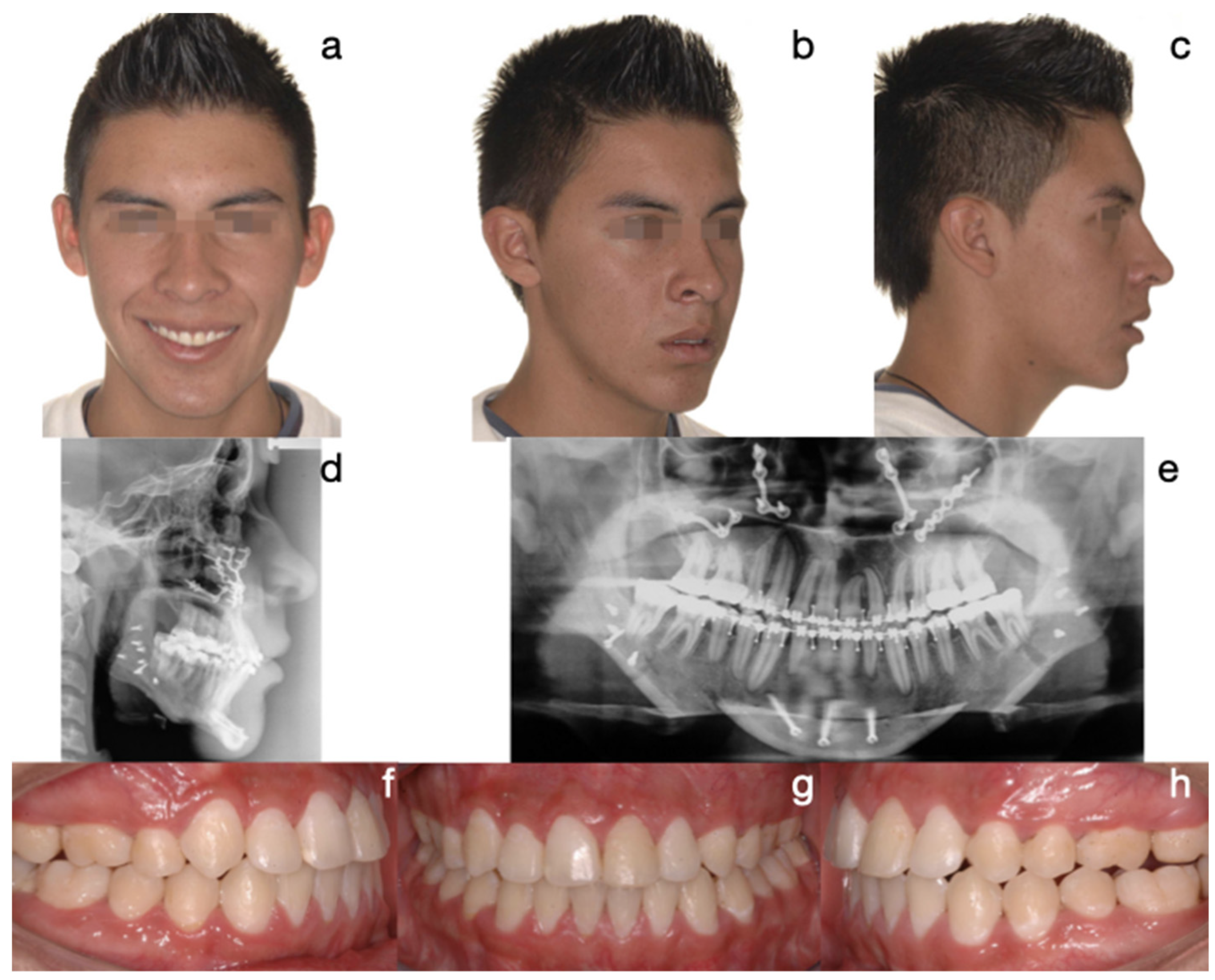 Diagnostics 15 00809 g006