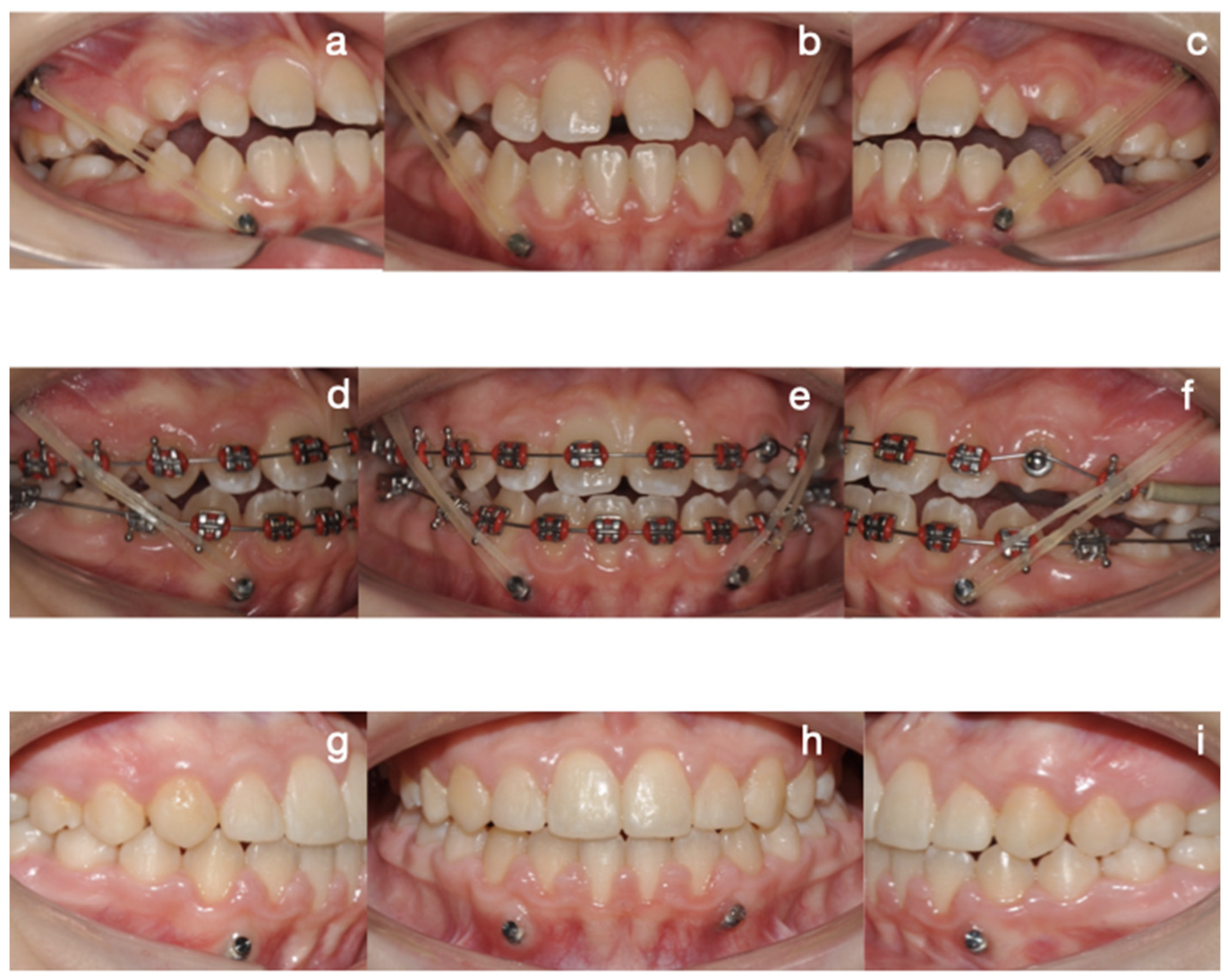 Diagnostics 15 00809 g009