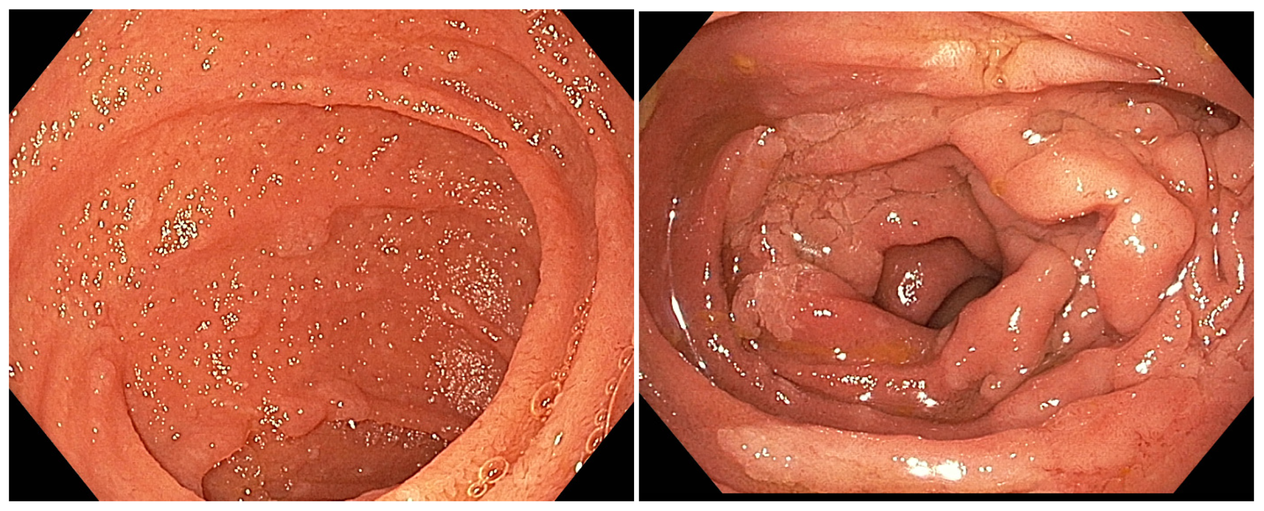 Diagnostics 15 00819 g001