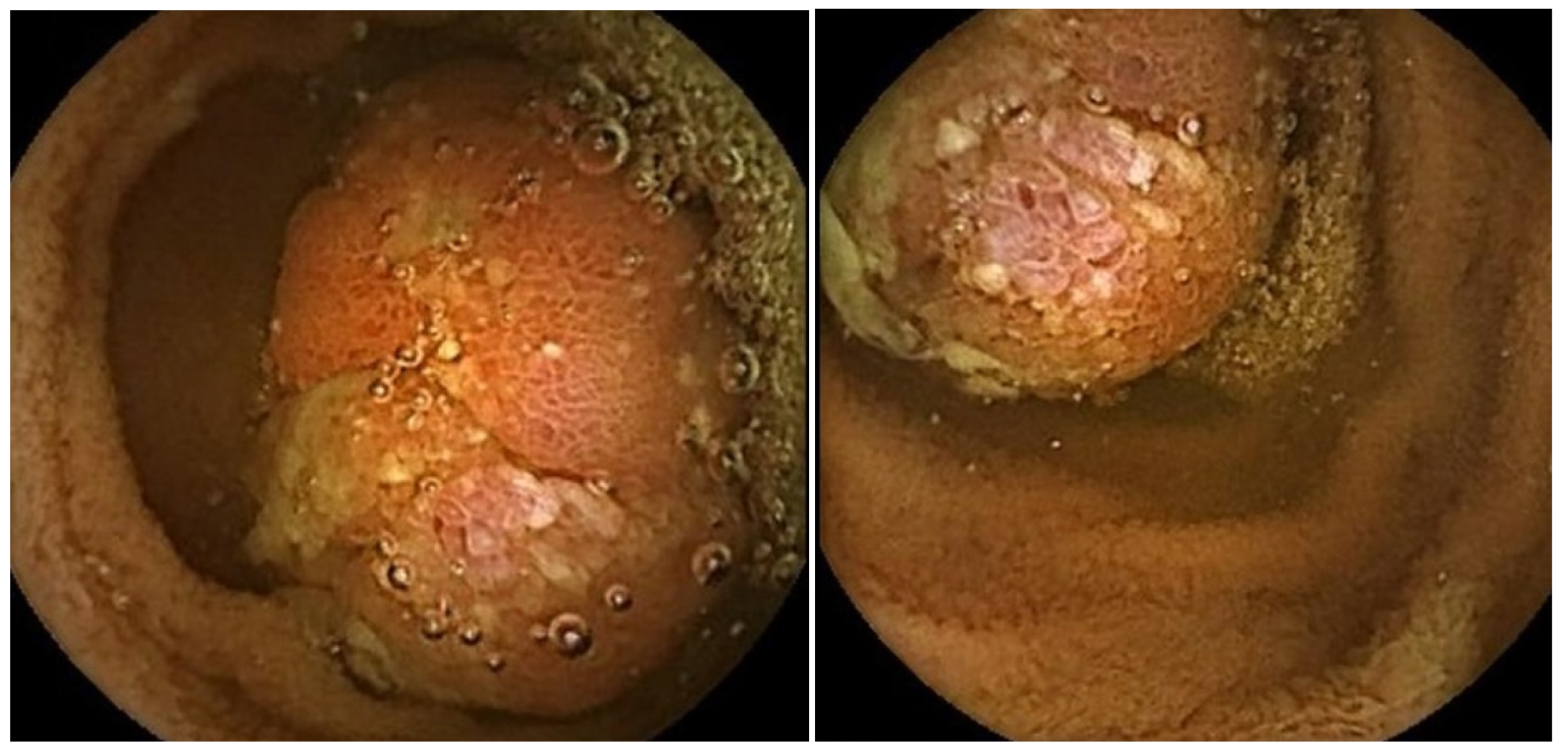 Diagnostics 15 00819 g004