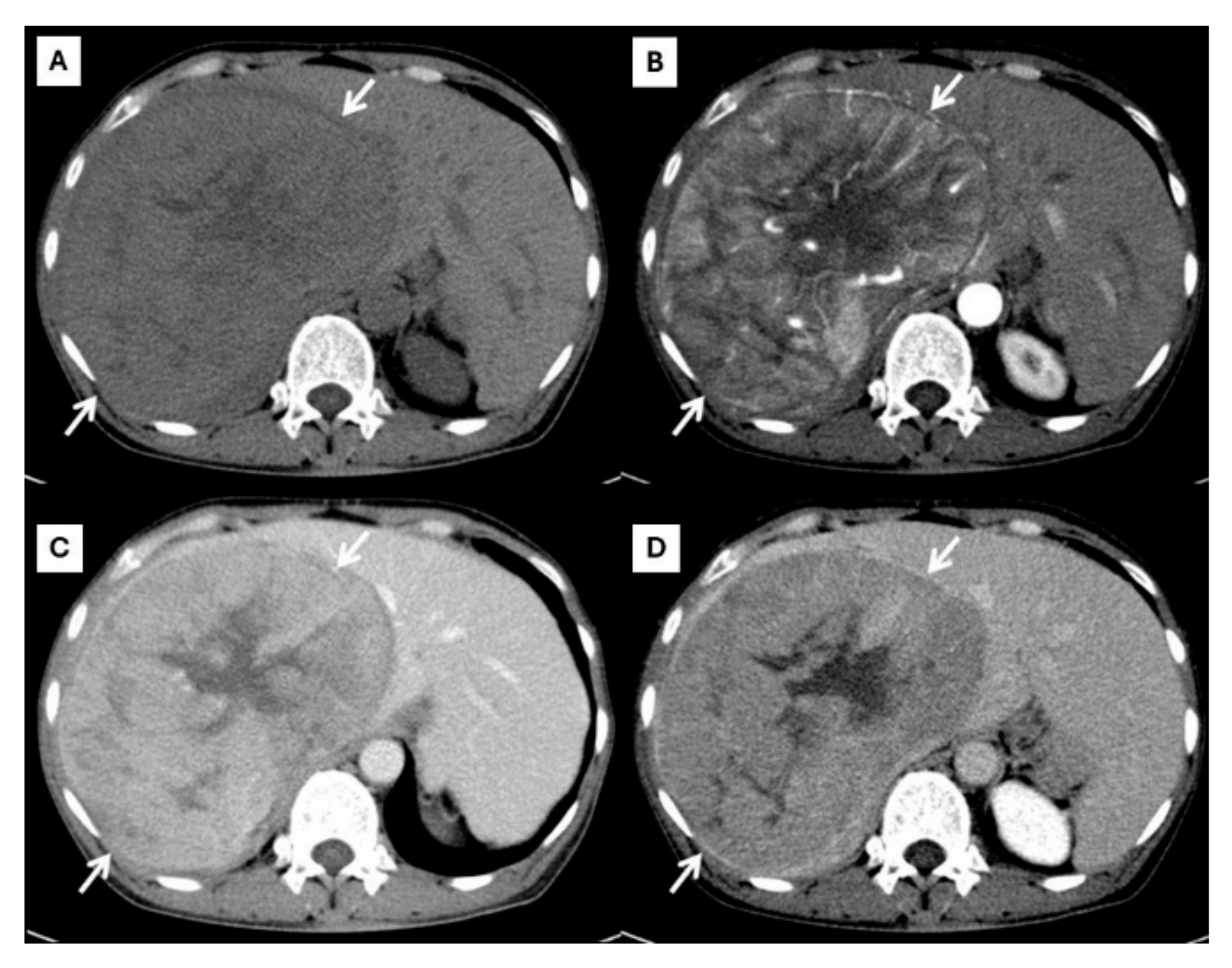 Diagnostics 15 00821 g001