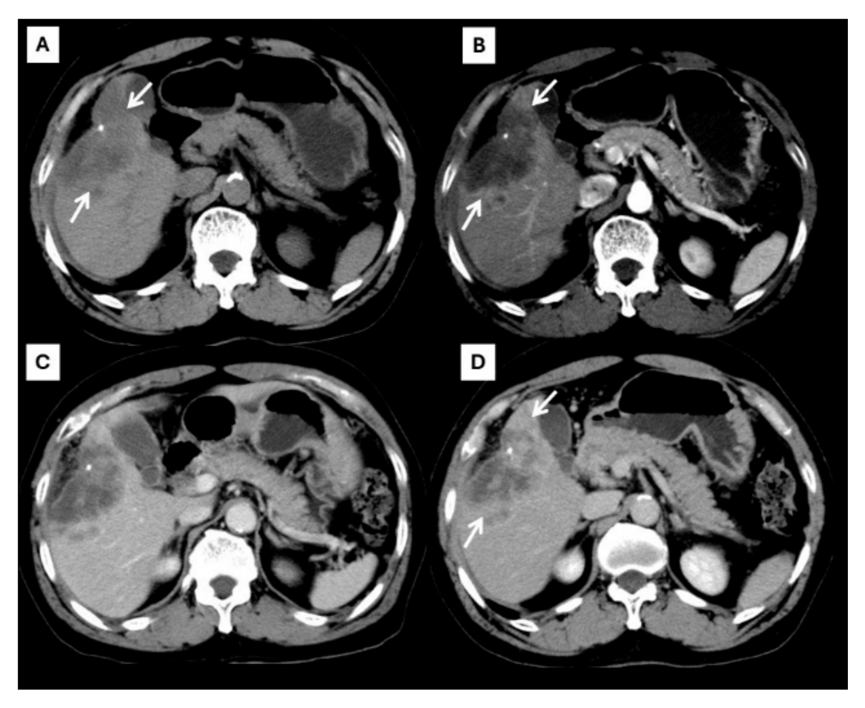 Diagnostics 15 00821 g002