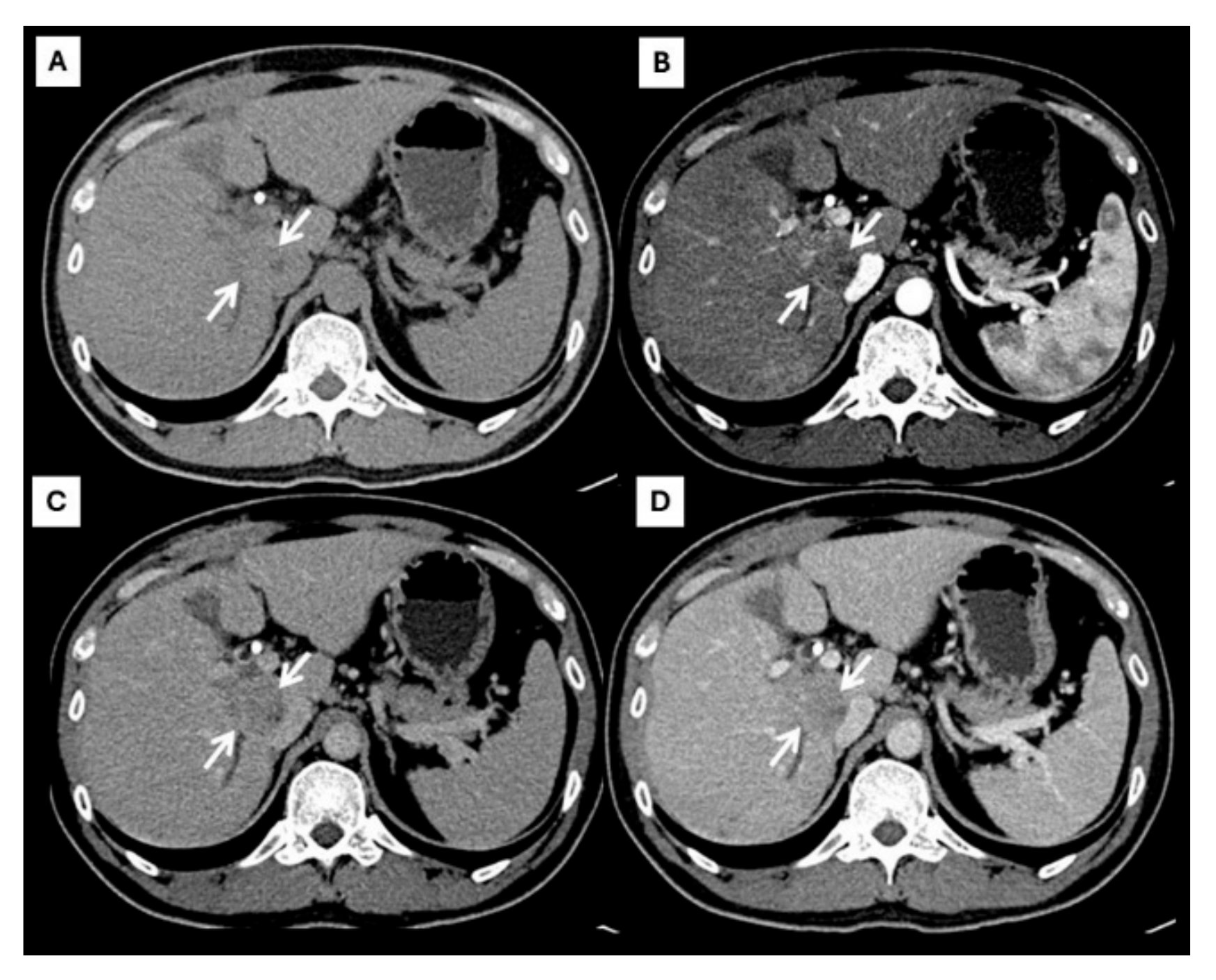 Diagnostics 15 00821 g003