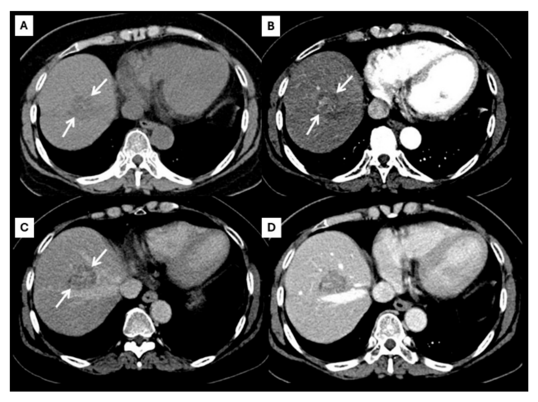 Diagnostics 15 00821 g004