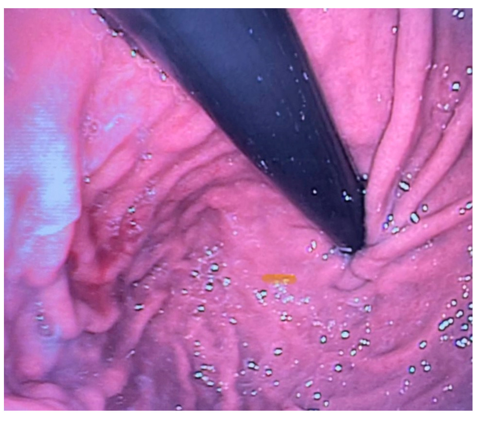 Diagnostics 15 00843 g003