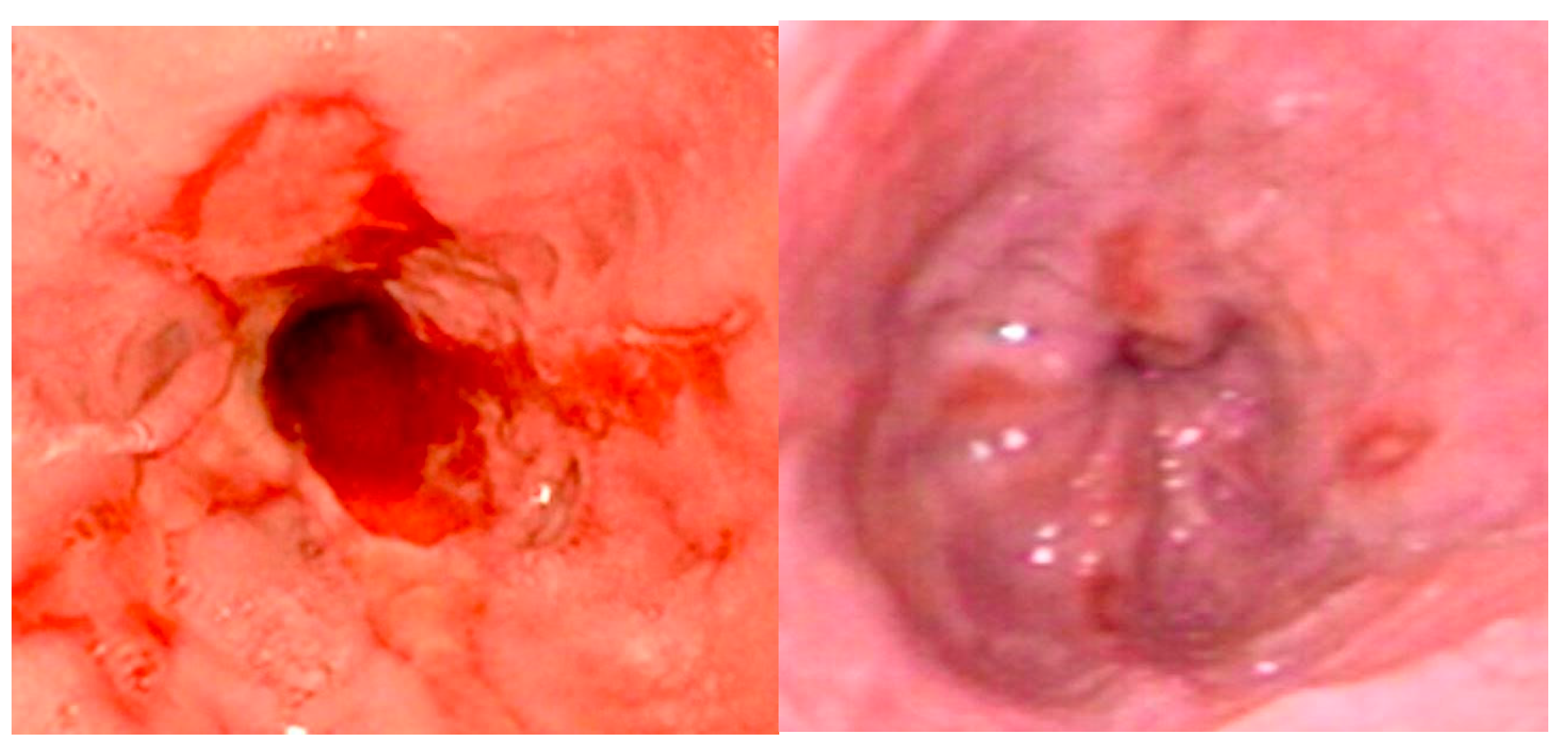 Diagnostics 15 00843 g004