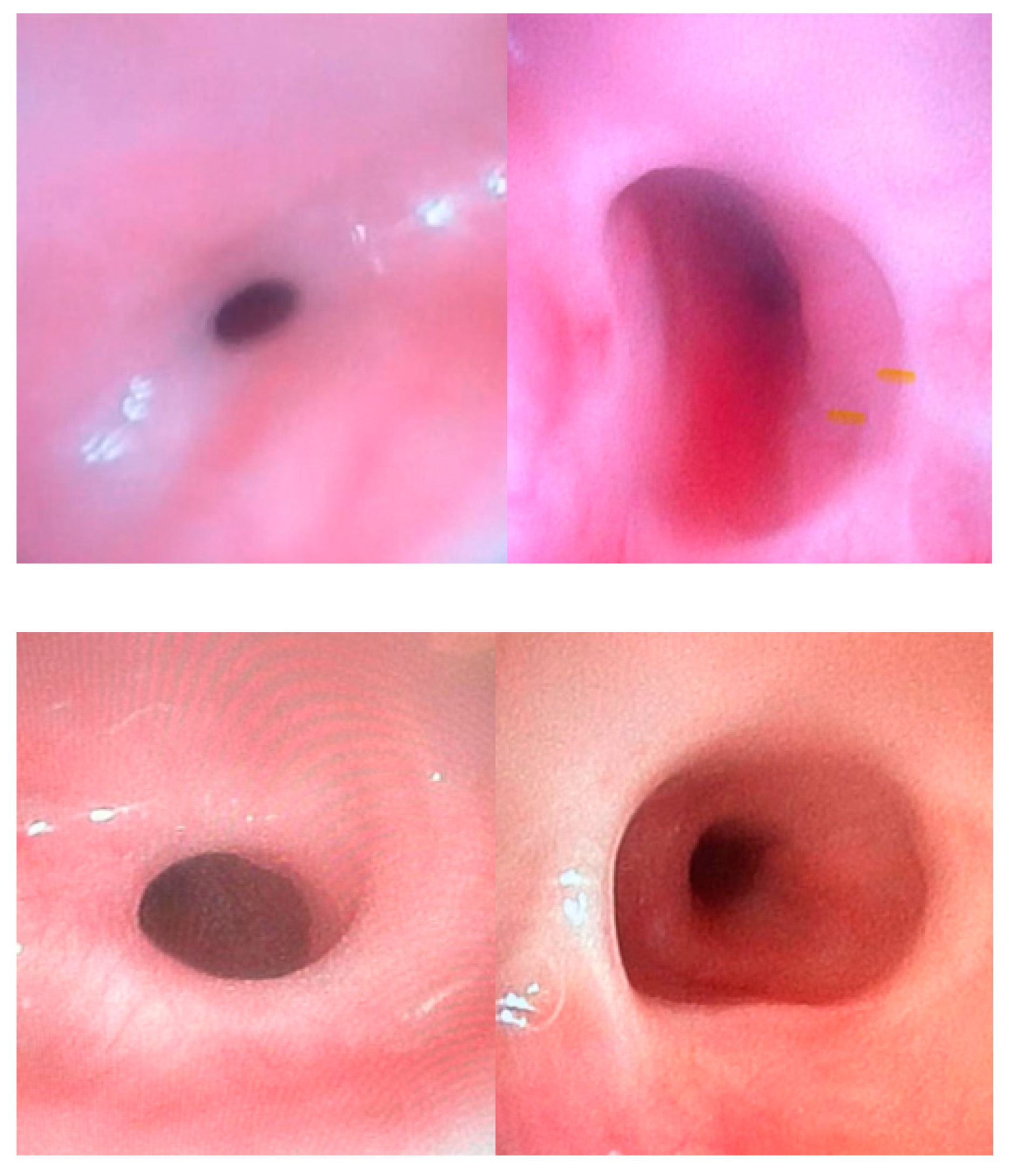 Diagnostics 15 00843 g006