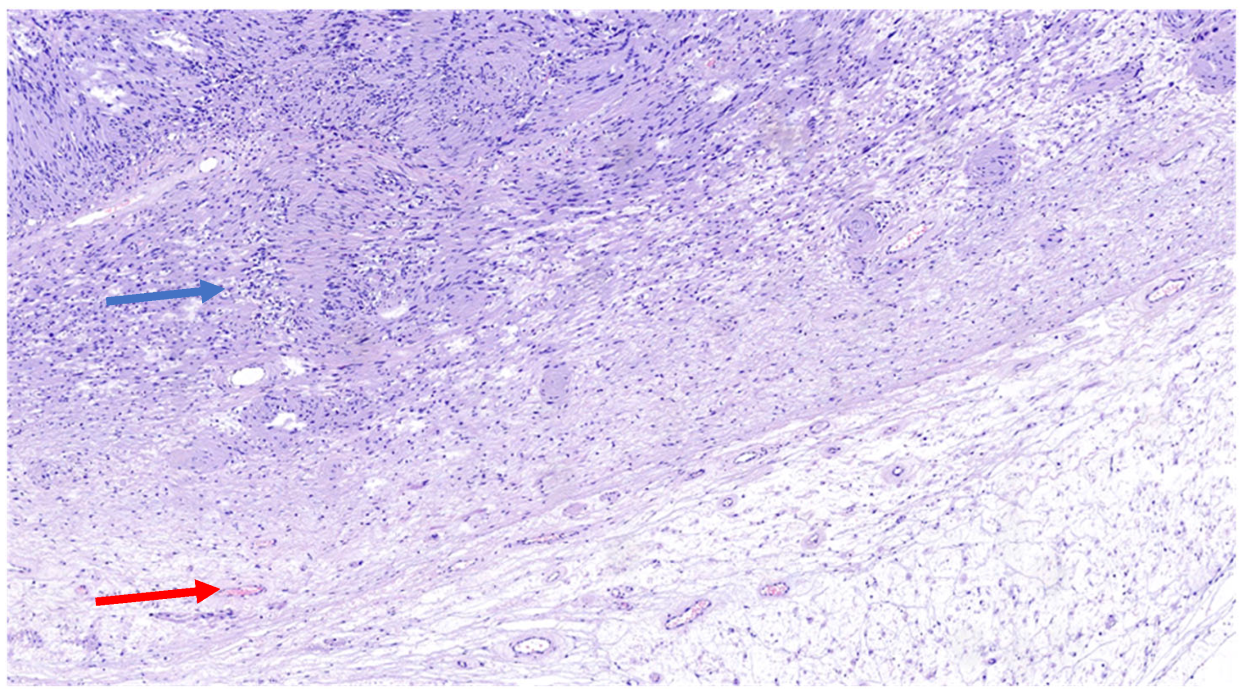 Diagnostics 15 00855 g003