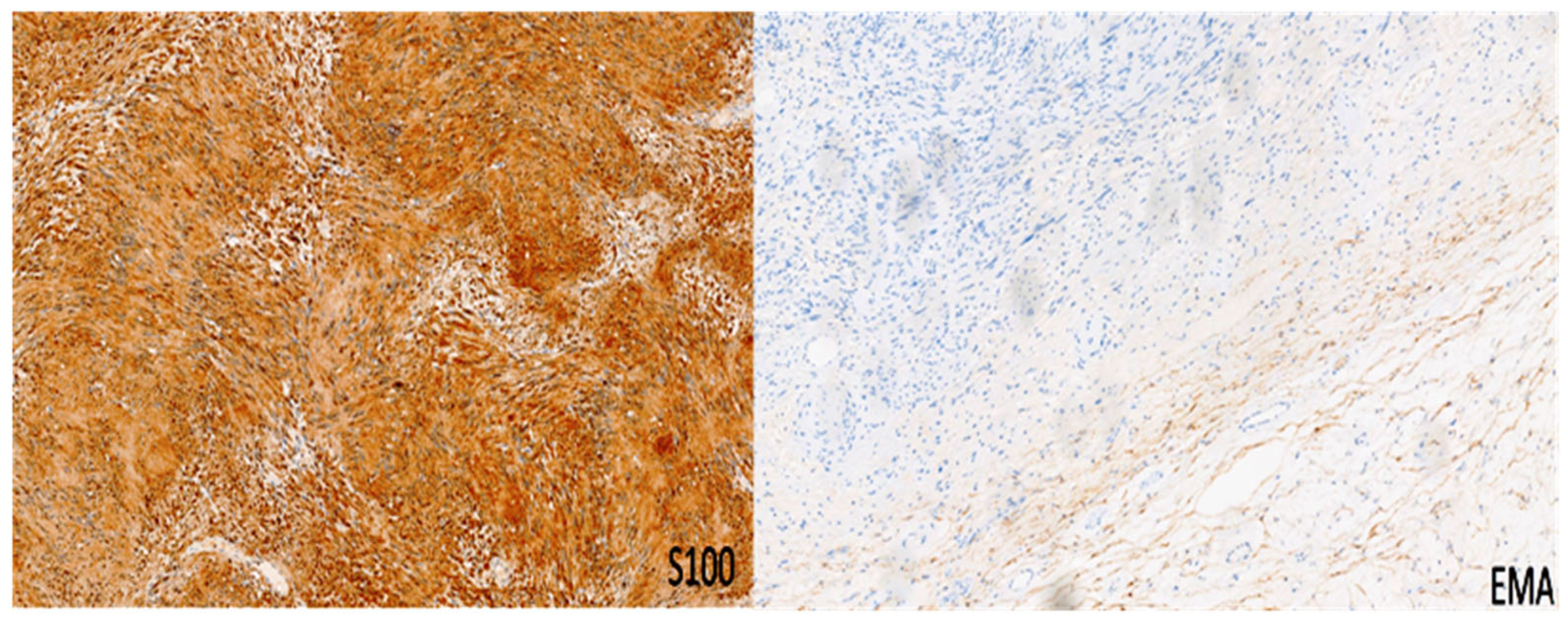 Diagnostics 15 00855 g004