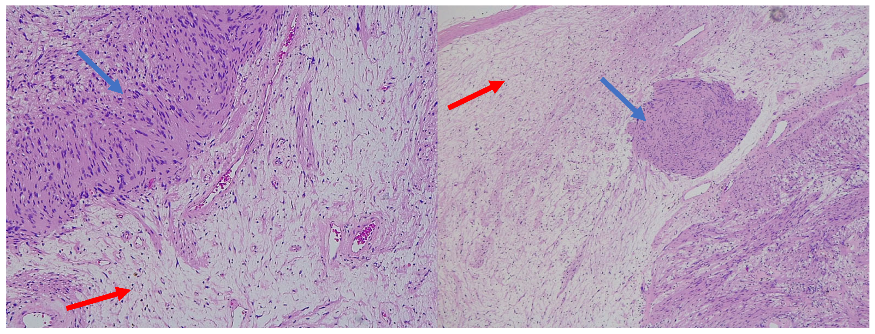 Diagnostics 15 00855 g005