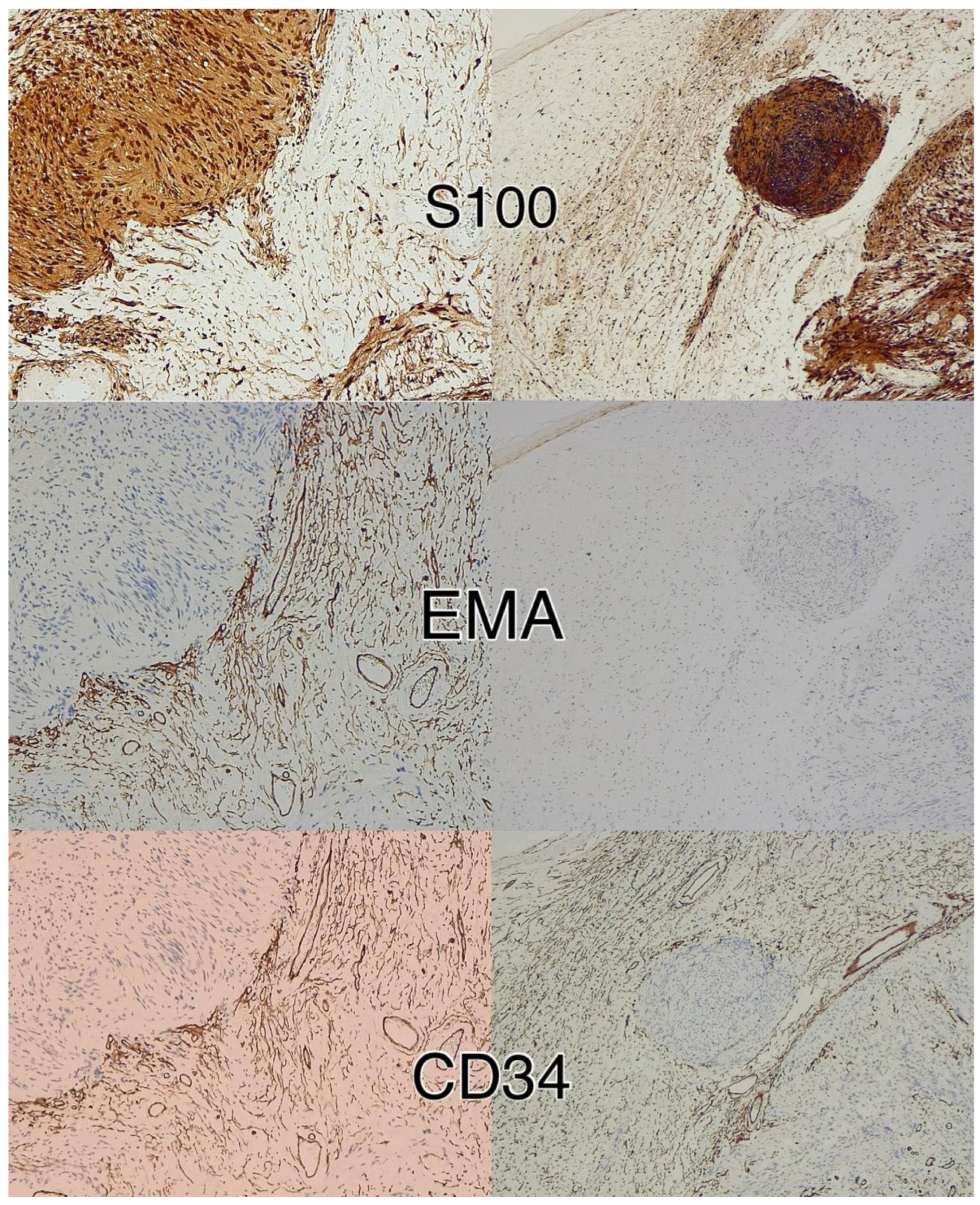 Diagnostics 15 00855 g006