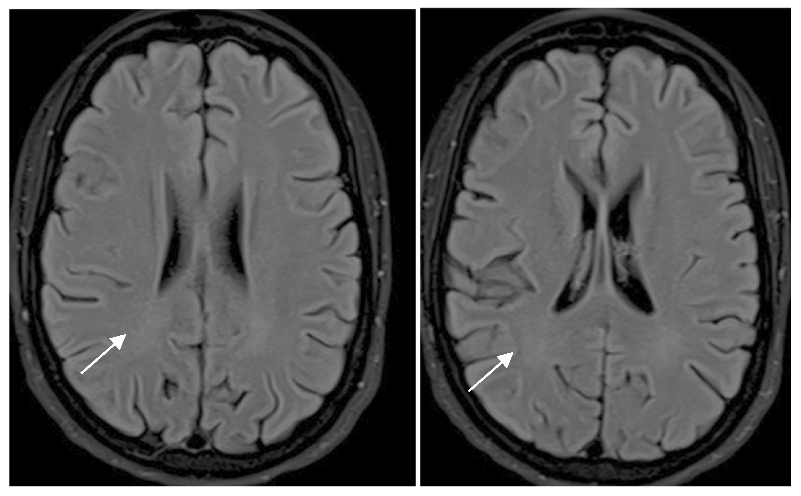 Diagnostics 15 00857 g002