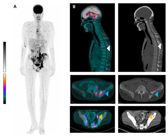 Diagnostics 15 00862 g001