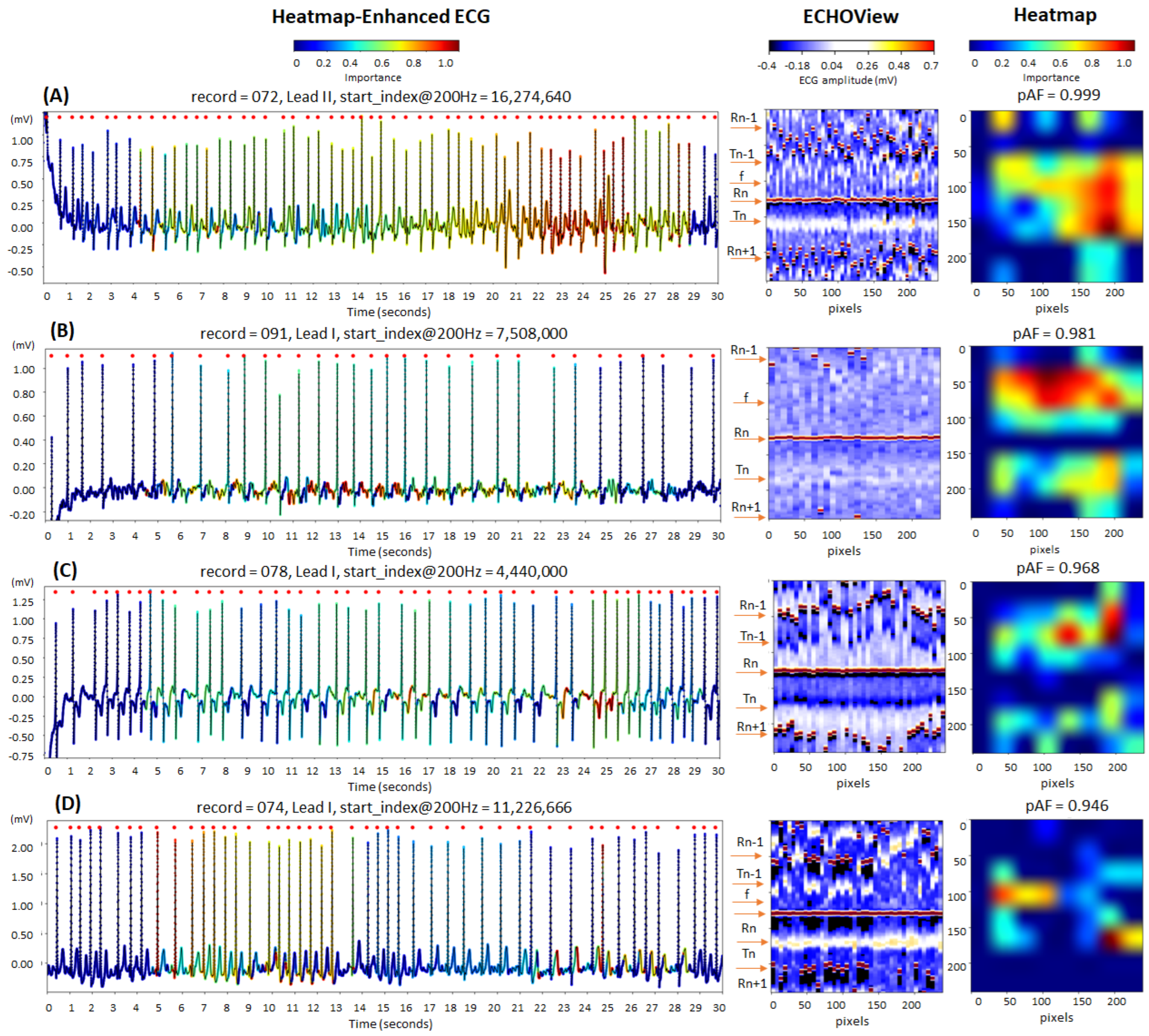 Diagnostics 15 00865 g014