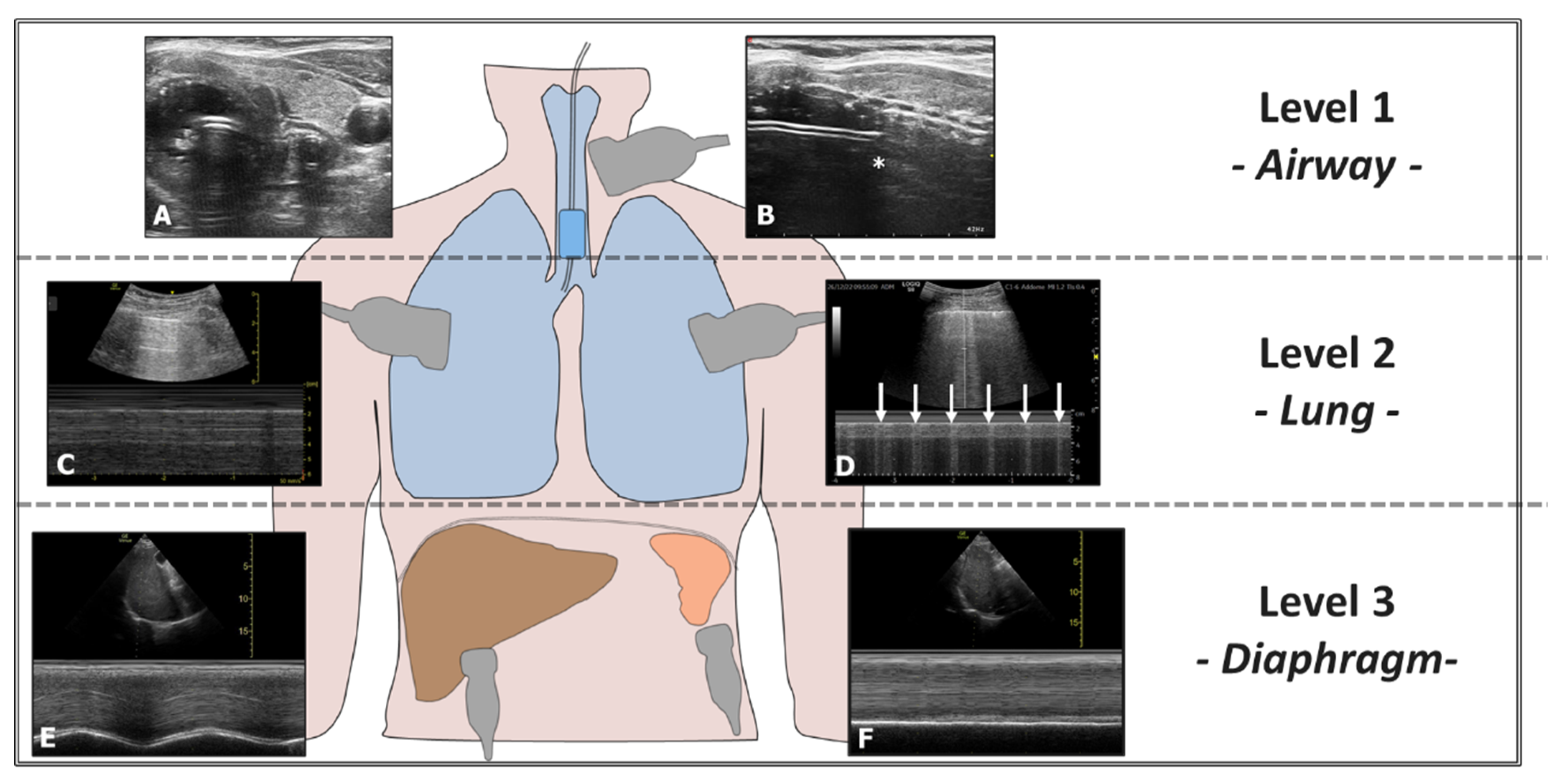 Diagnostics 15 00870 g007