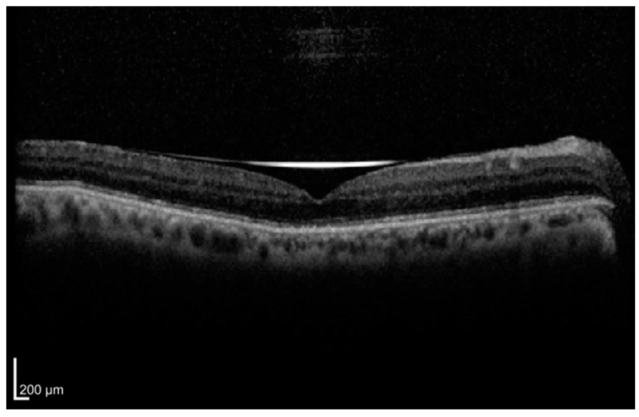 Diagnostics 15 00871 g001