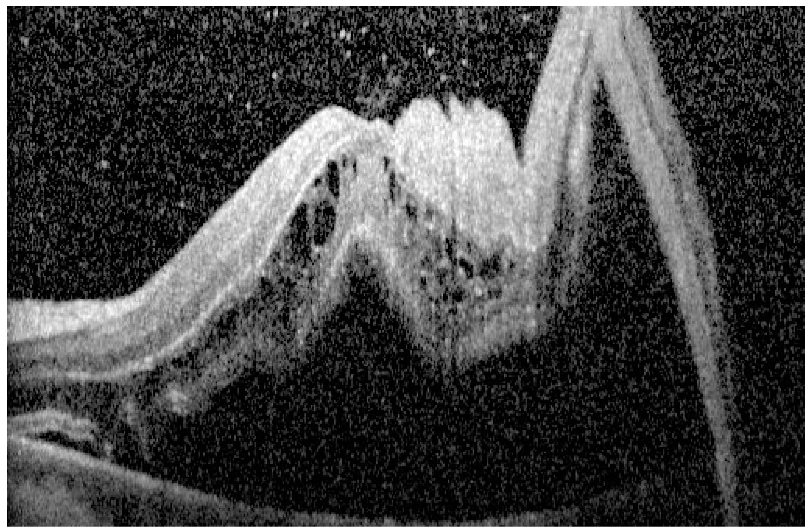 Diagnostics 15 00871 g003