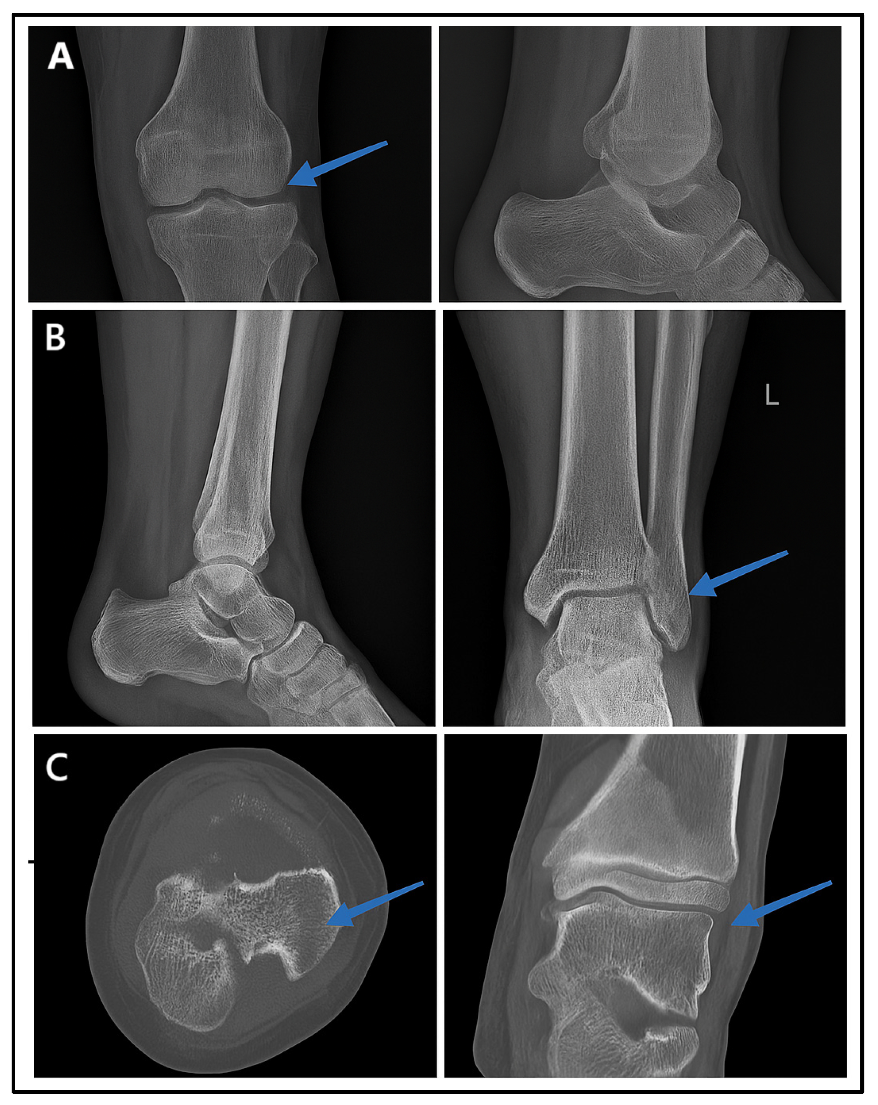 Diagnostics 15 00876 g006