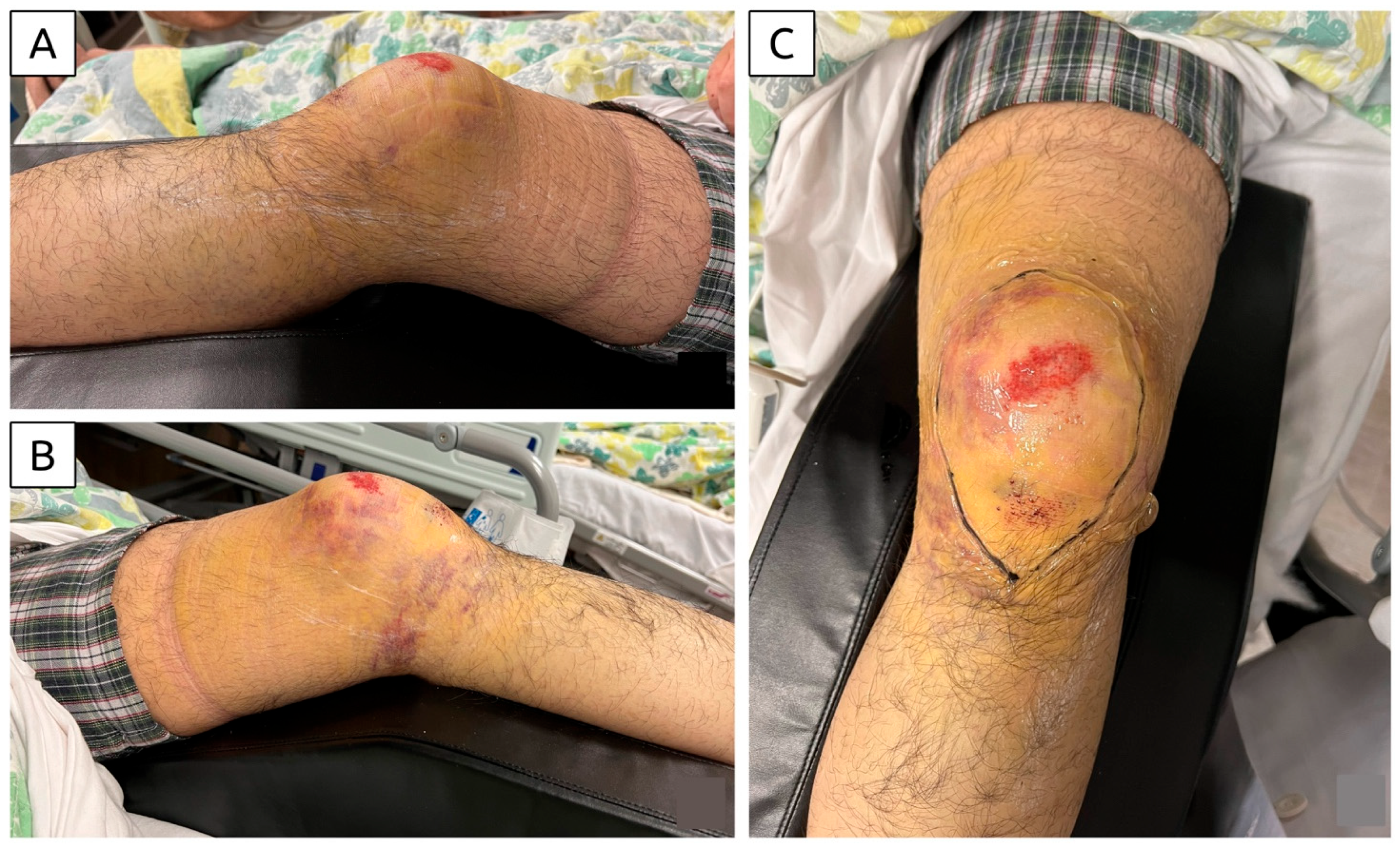 Diagnostics 15 00883 g001