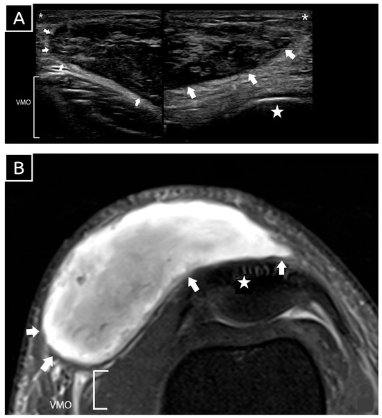 Diagnostics 15 00883 g002