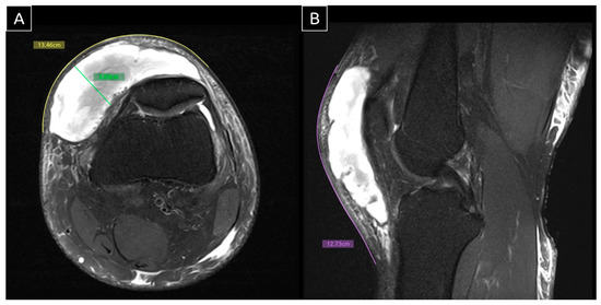 Diagnostics 15 00883 g003