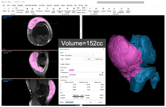 Diagnostics 15 00883 g004