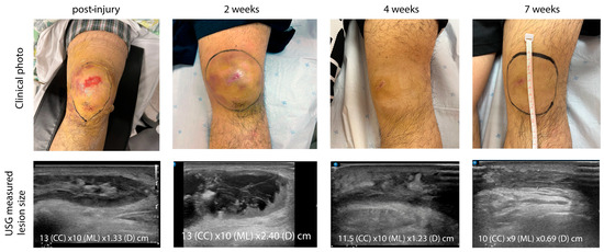Diagnostics 15 00883 g005