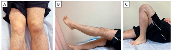 Diagnostics 15 00883 g006