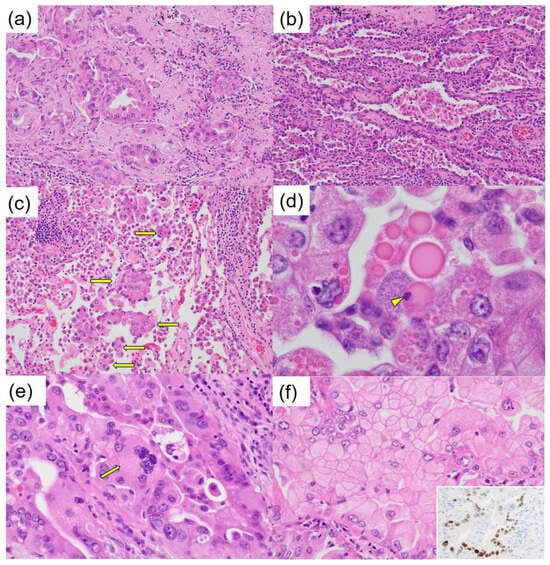 Diagnostics 15 00894 g003