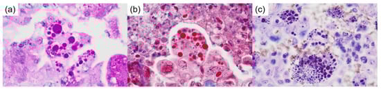 Diagnostics 15 00894 g004