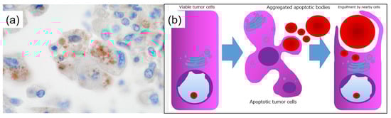 Diagnostics 15 00894 g005