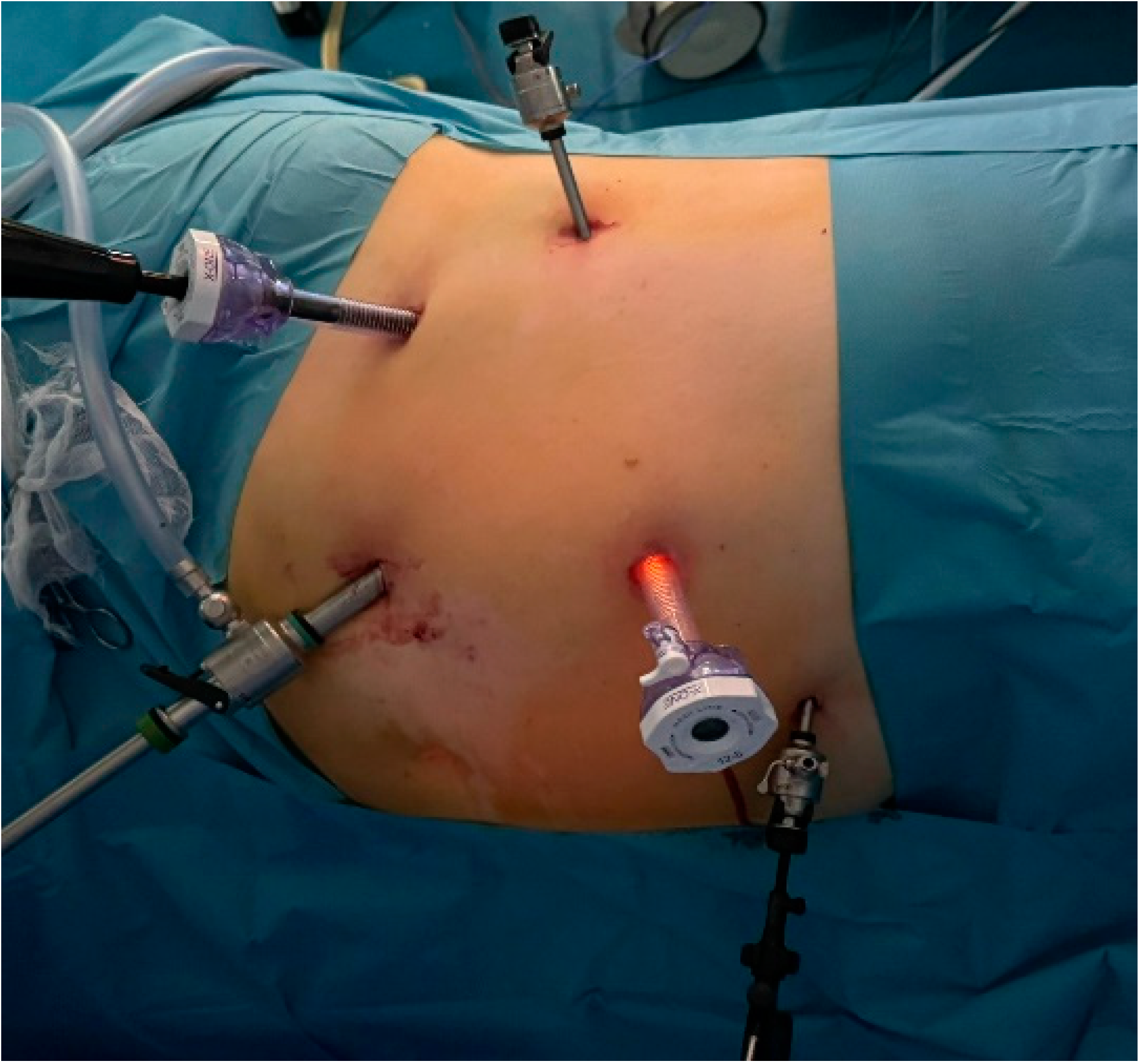 Diagnostics 15 00898 g002 Diagnostics 15 00898 g002