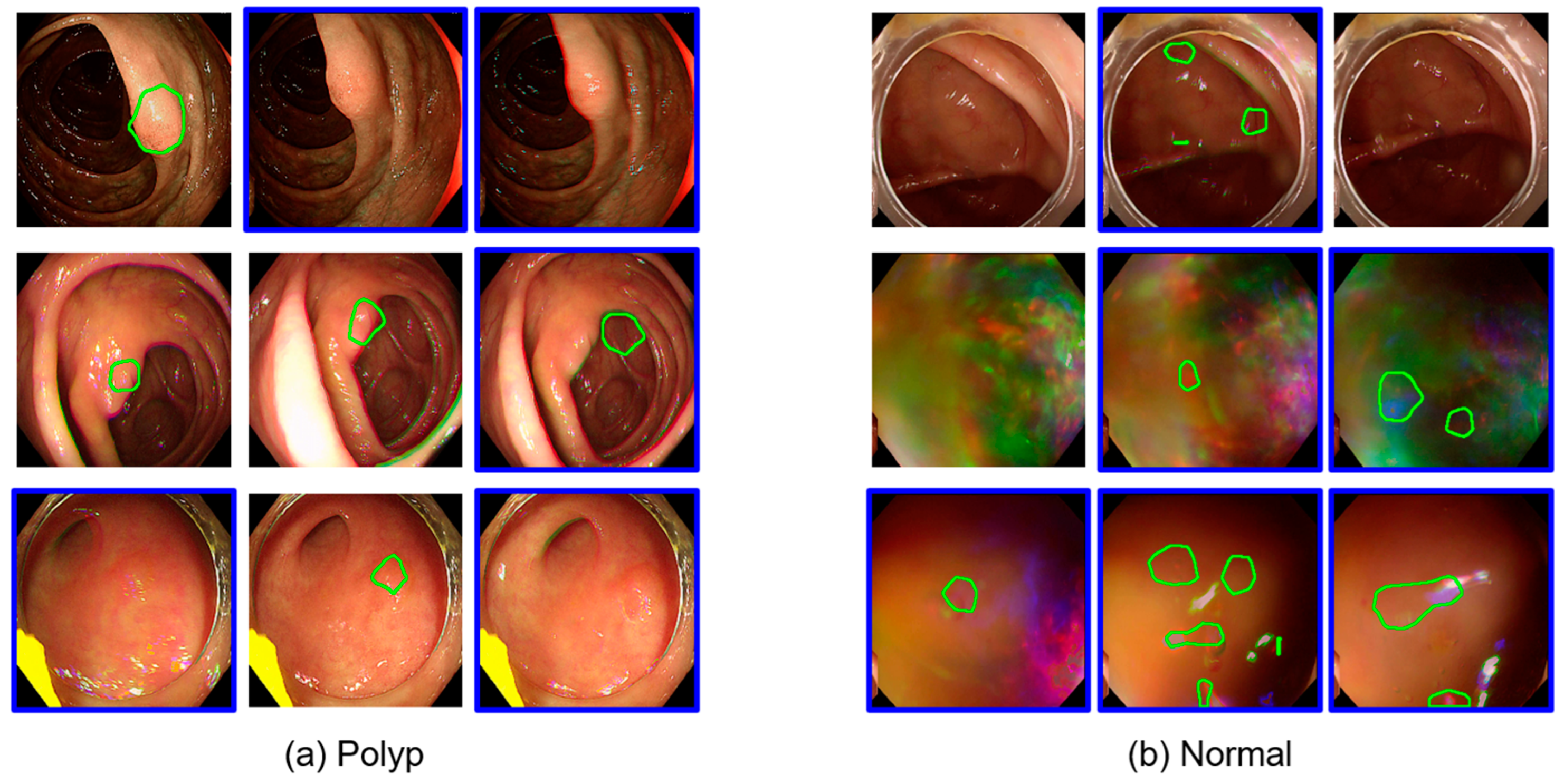 Diagnostics 15 00901 g002