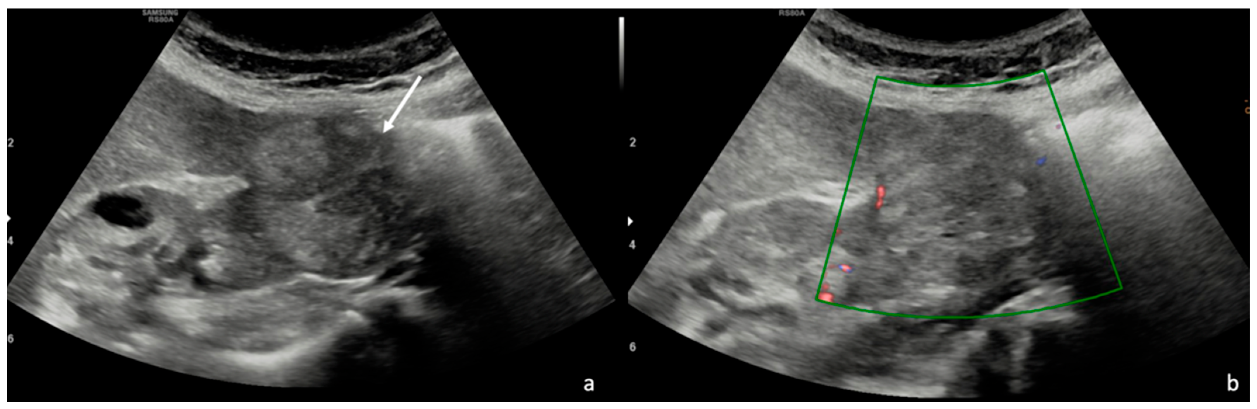 Diagnostics 15 00906 g002