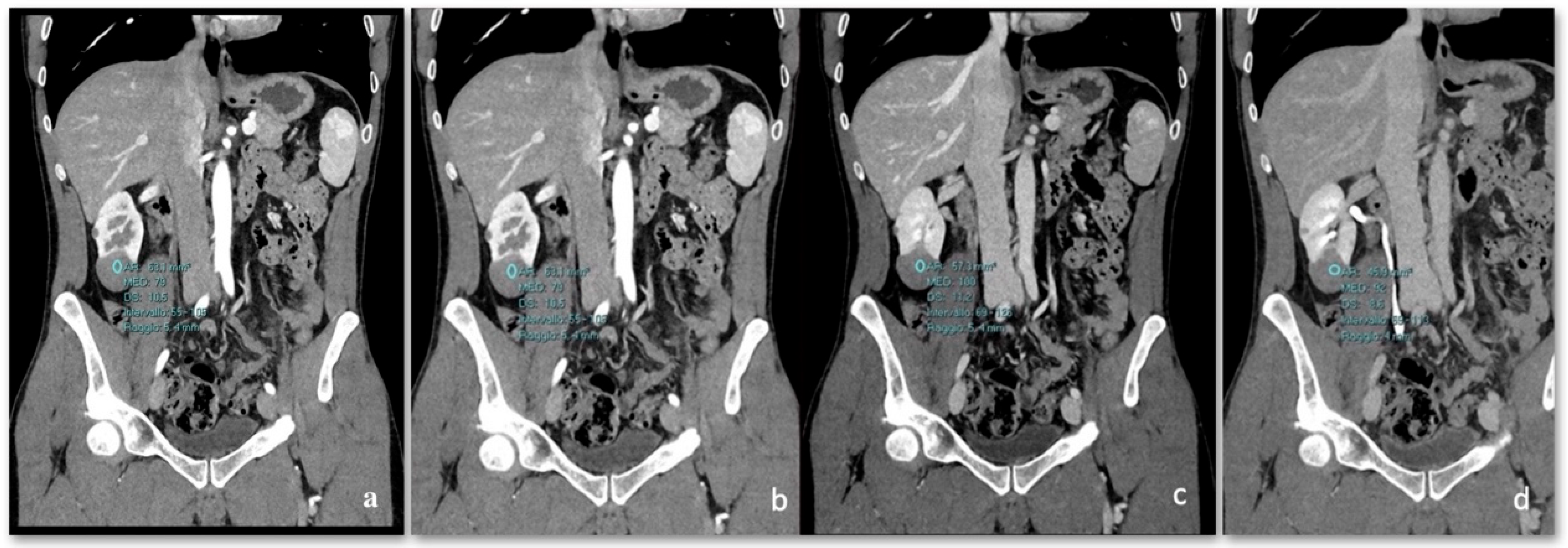 Diagnostics 15 00906 g005