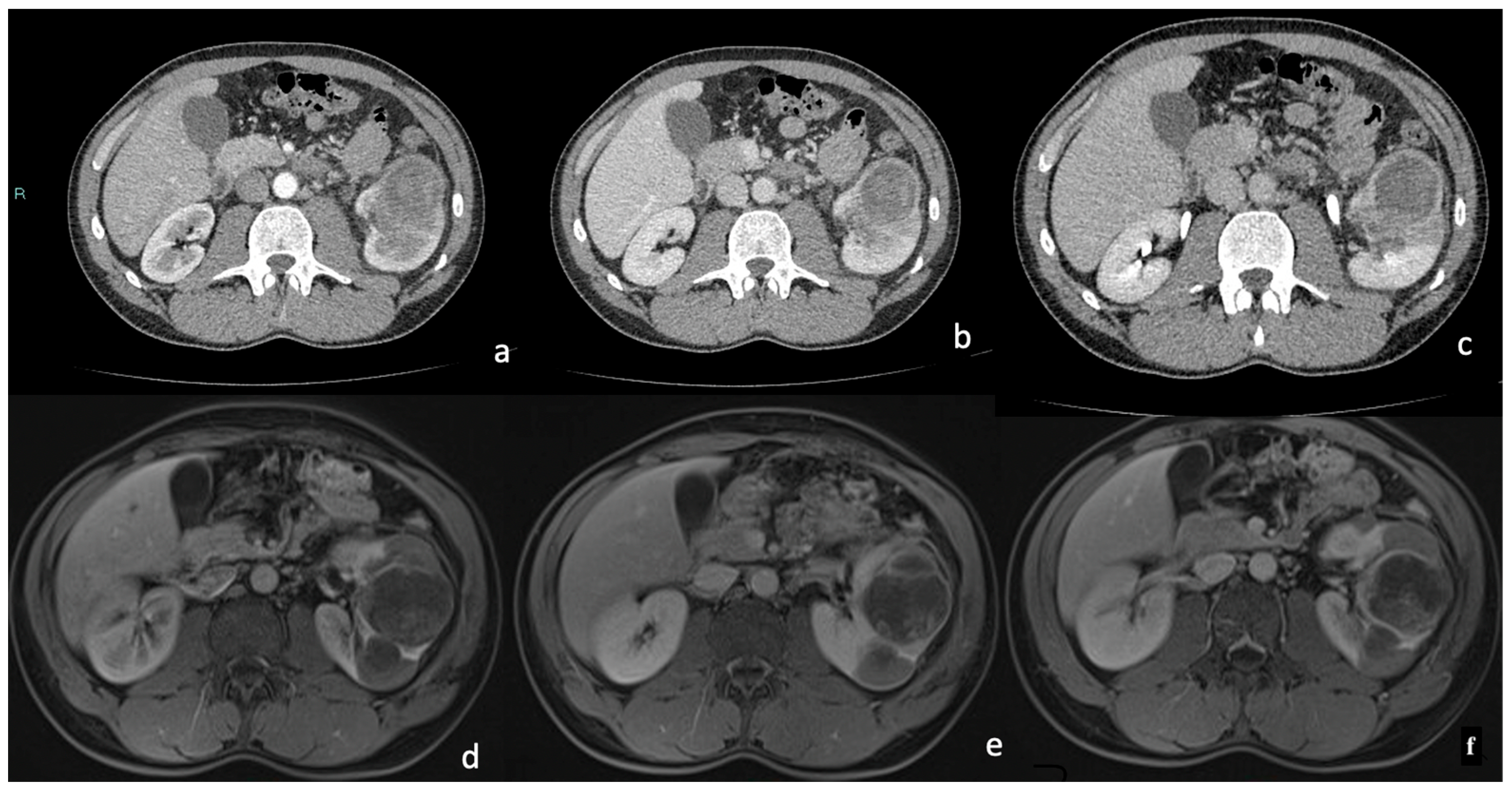 Diagnostics 15 00906 g008