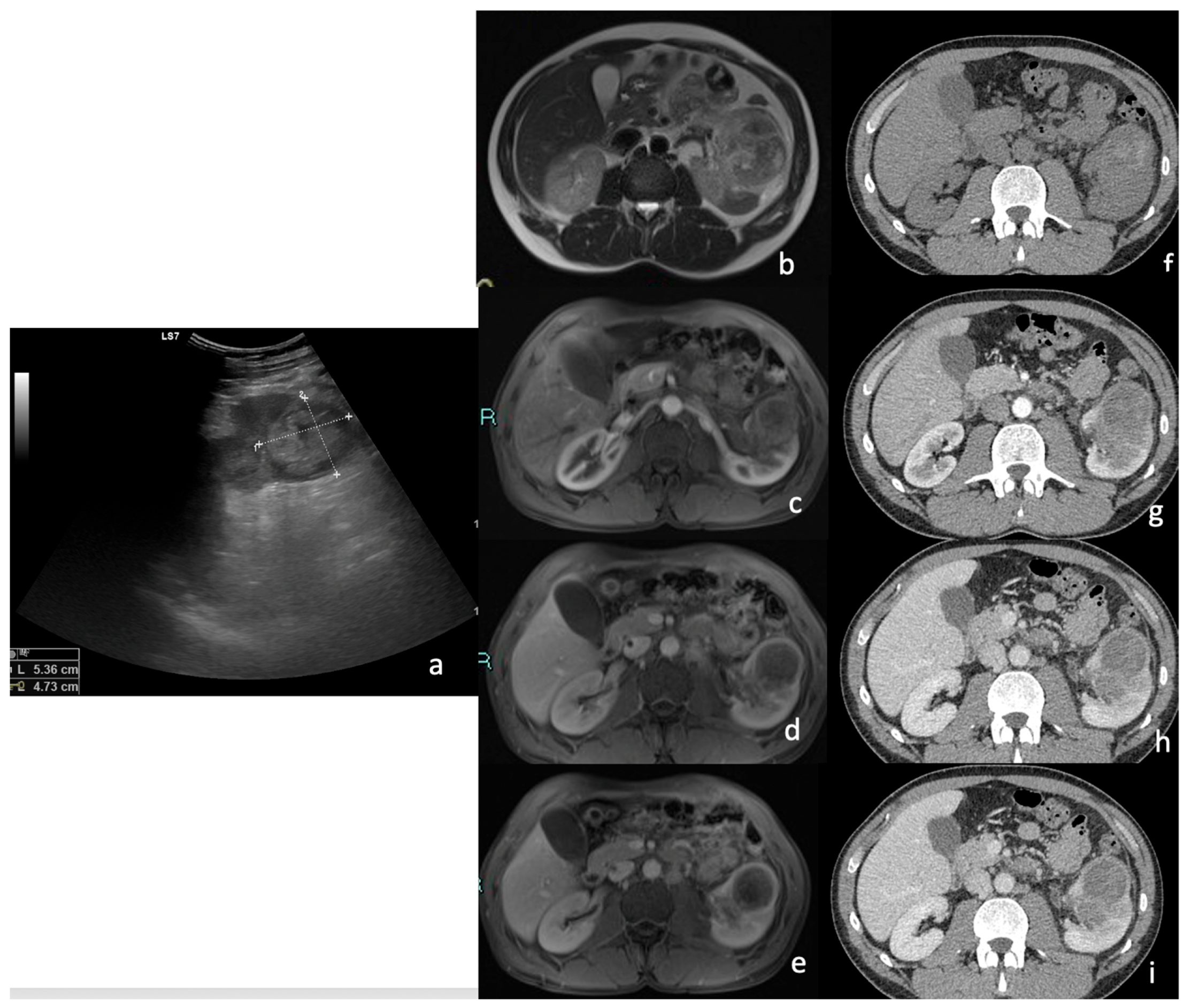 Diagnostics 15 00906 g009
