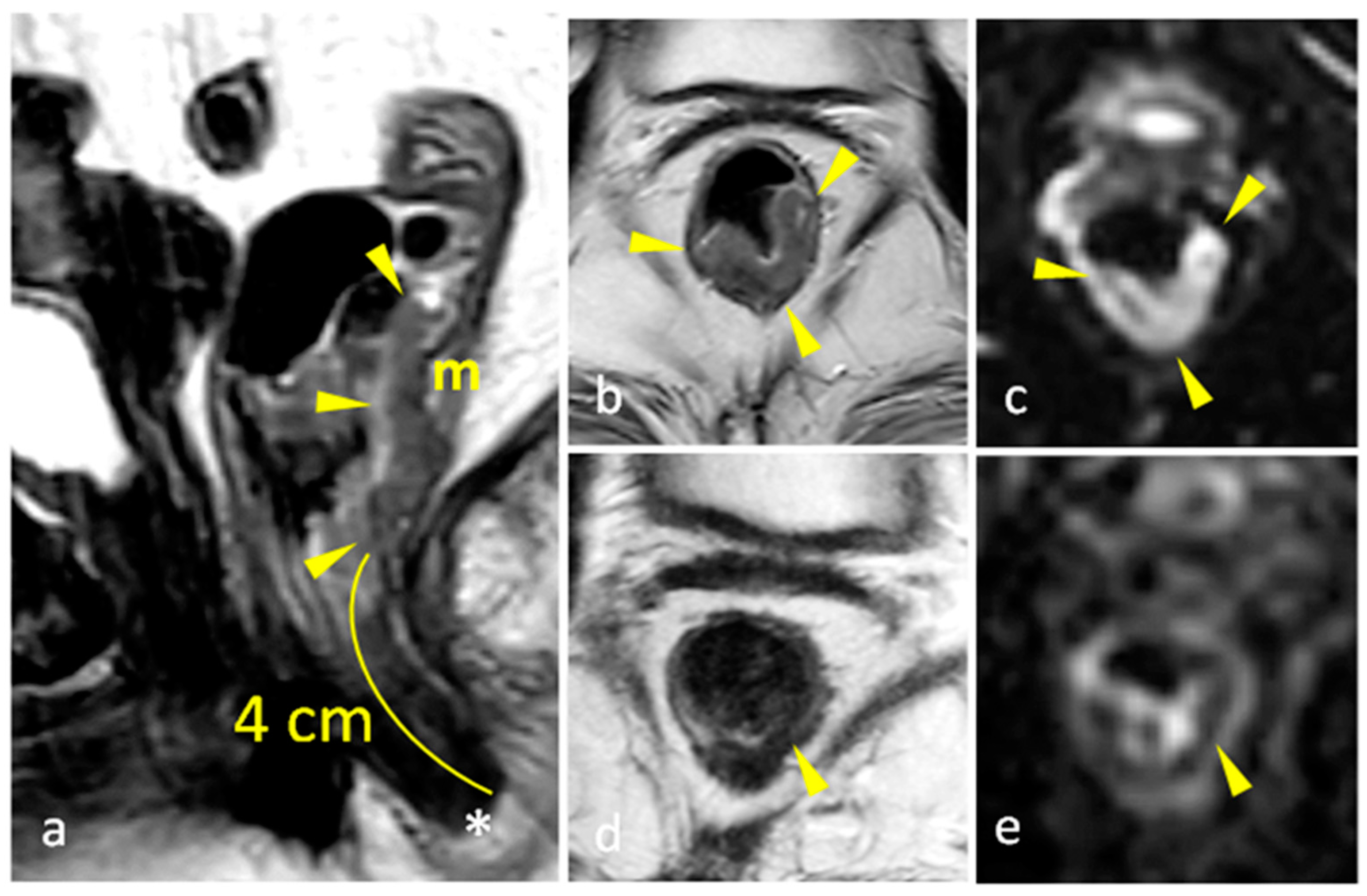 Diagnostics 15 00913 g002