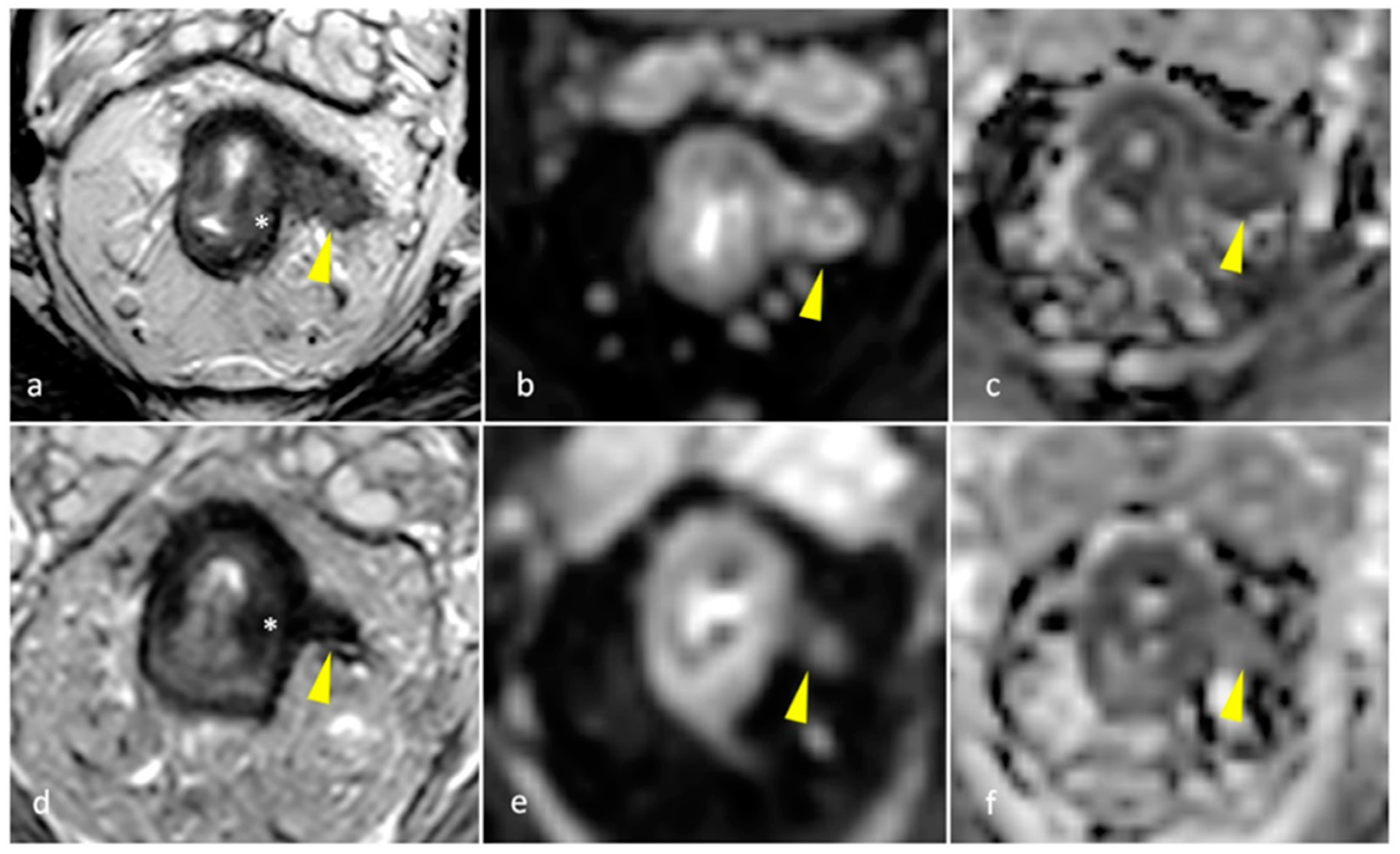 Diagnostics 15 00913 g004