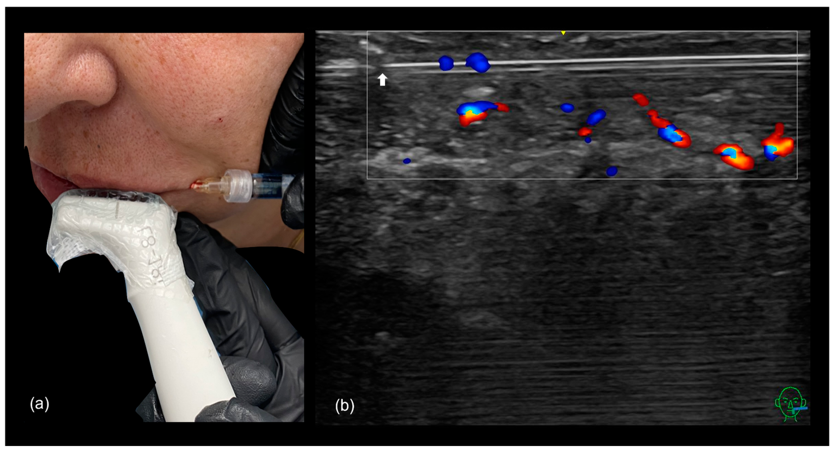 Diagnostics 15 00921 g016 Diagnostics 15 00921 g016