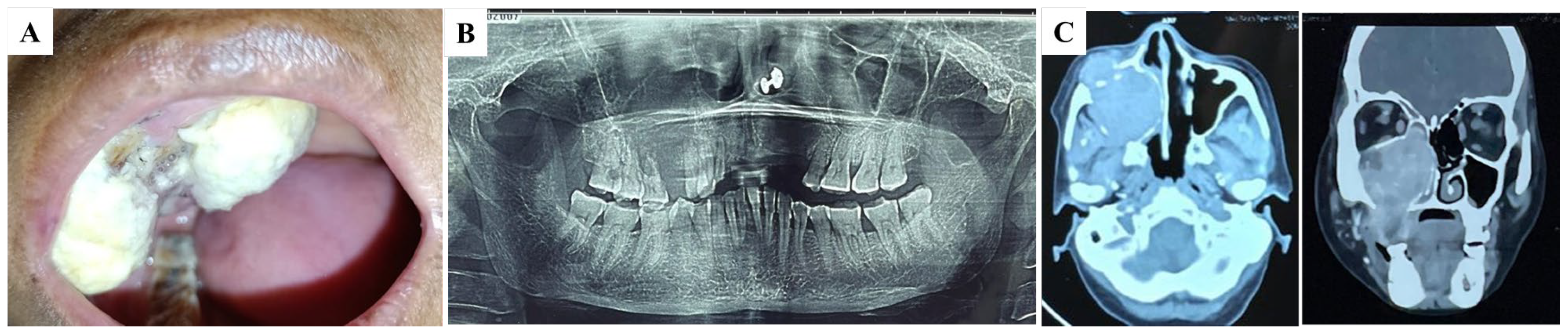 Diagnostics 15 00938 g001 Diagnostics 15 00938 g001