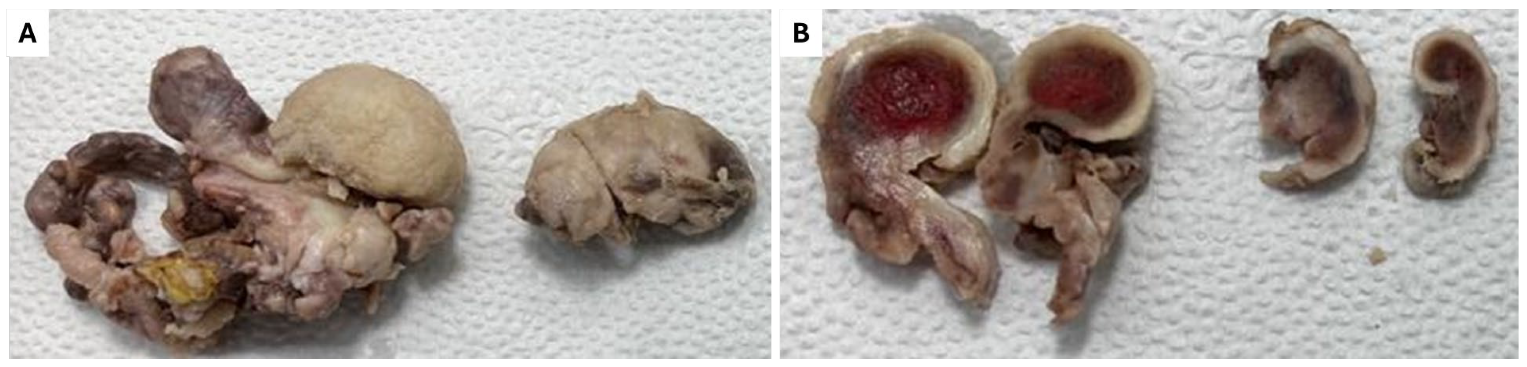 Diagnostics 15 00938 g004 Diagnostics 15 00938 g004