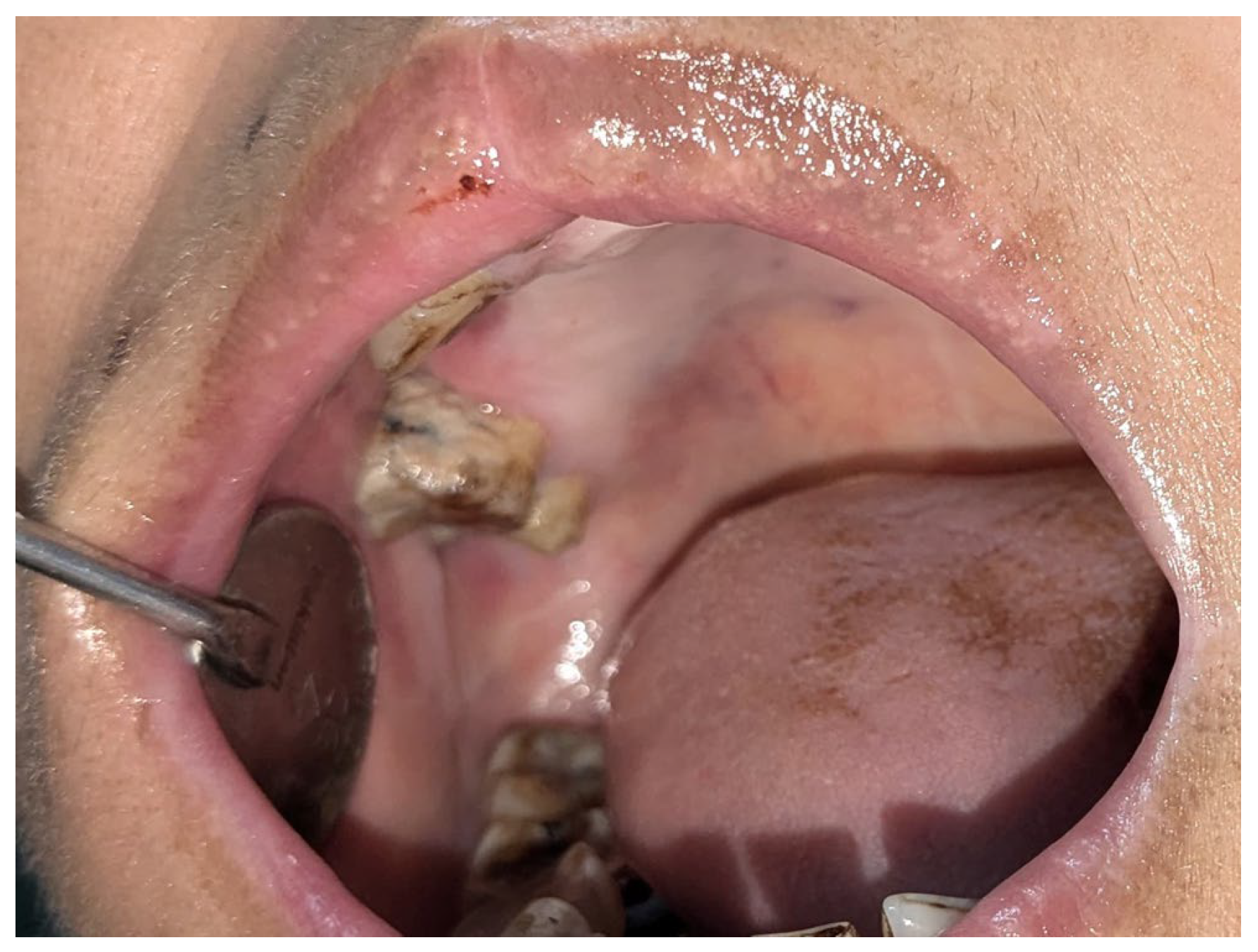 Diagnostics 15 00938 g006 Diagnostics 15 00938 g006