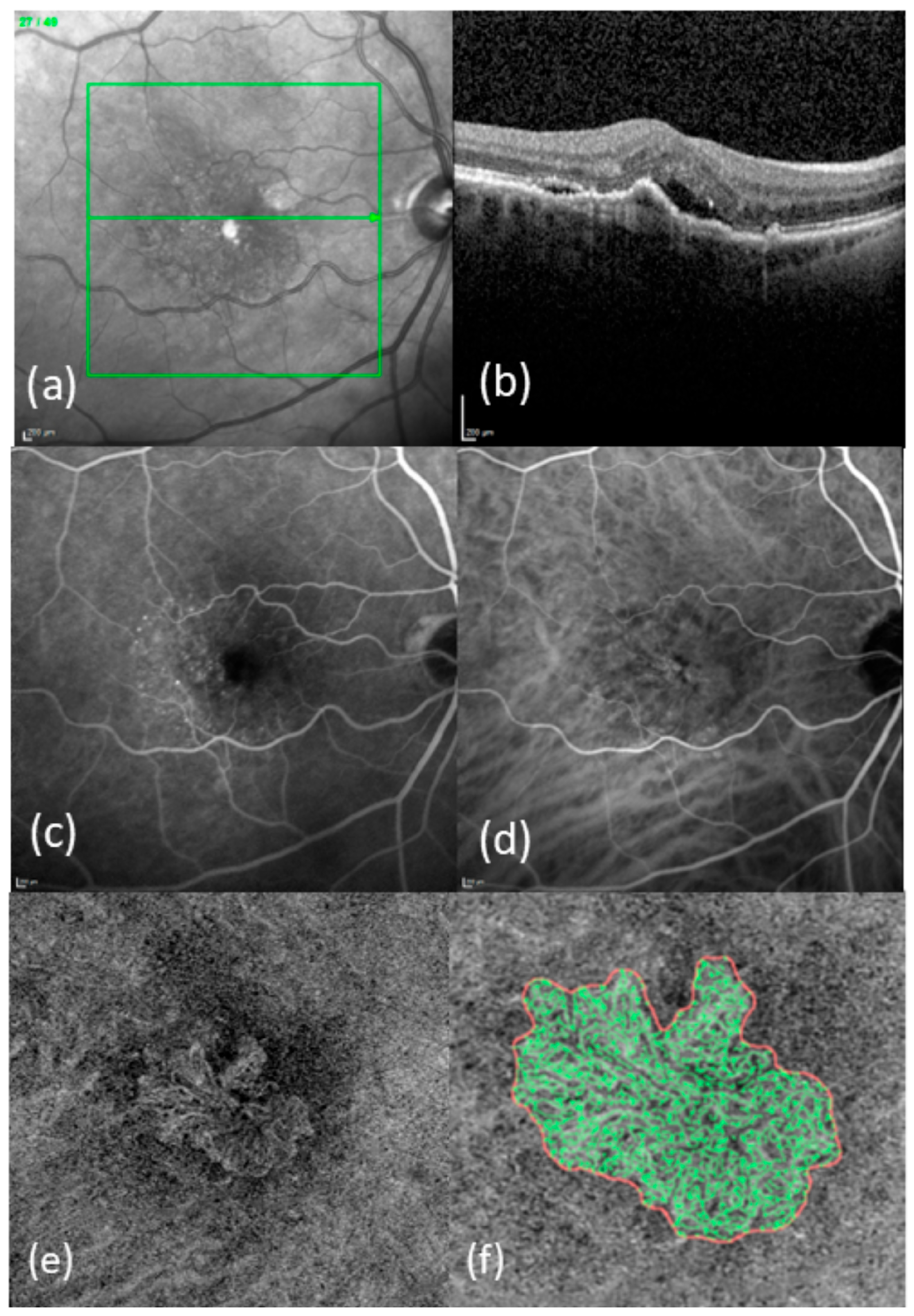Diagnostics 15 00982 g001
