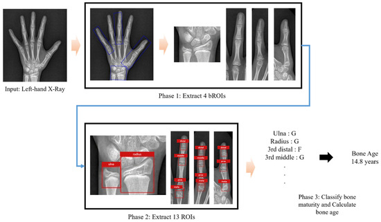 Diagnostics 15 00993 g0a1