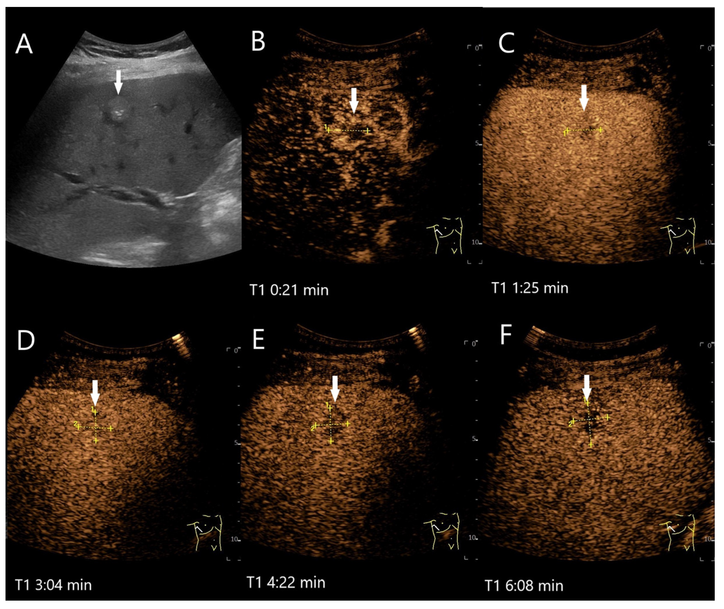 Diagnostics 15 00998 g002