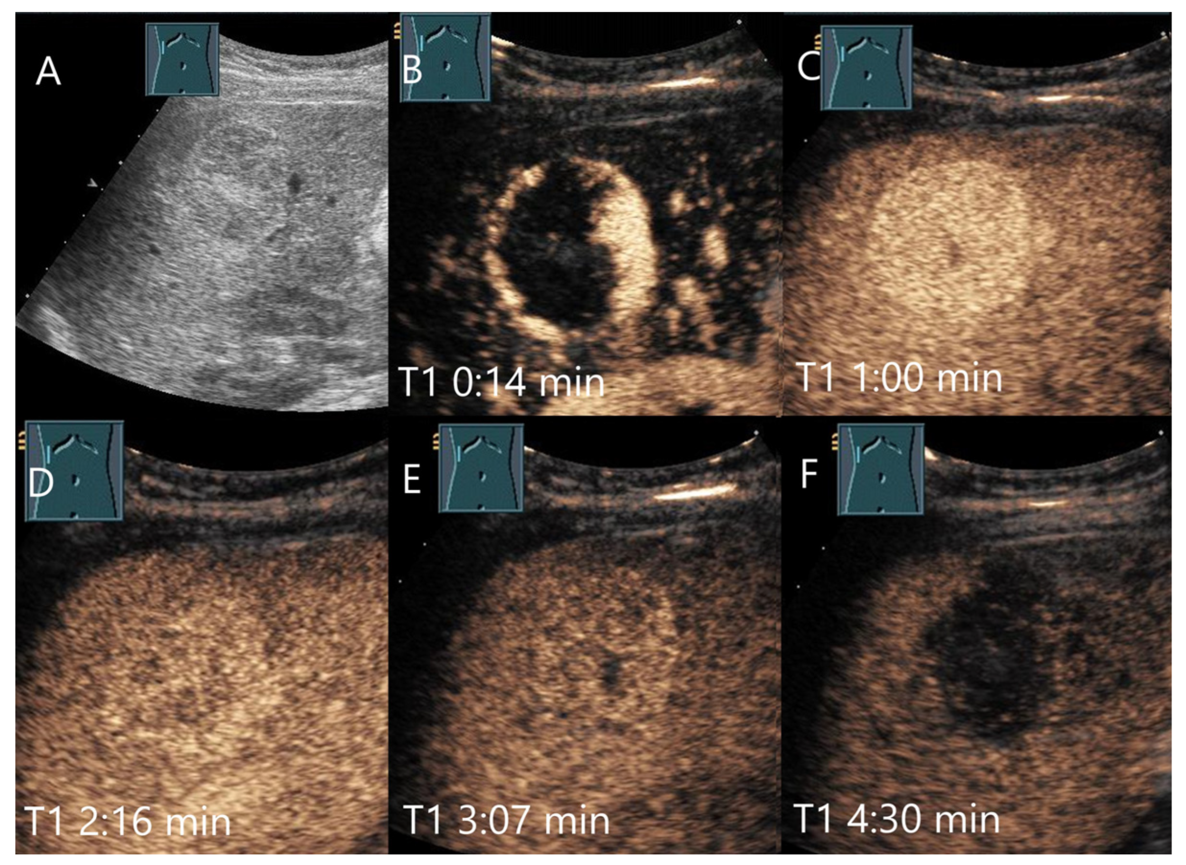 Diagnostics 15 00998 g003