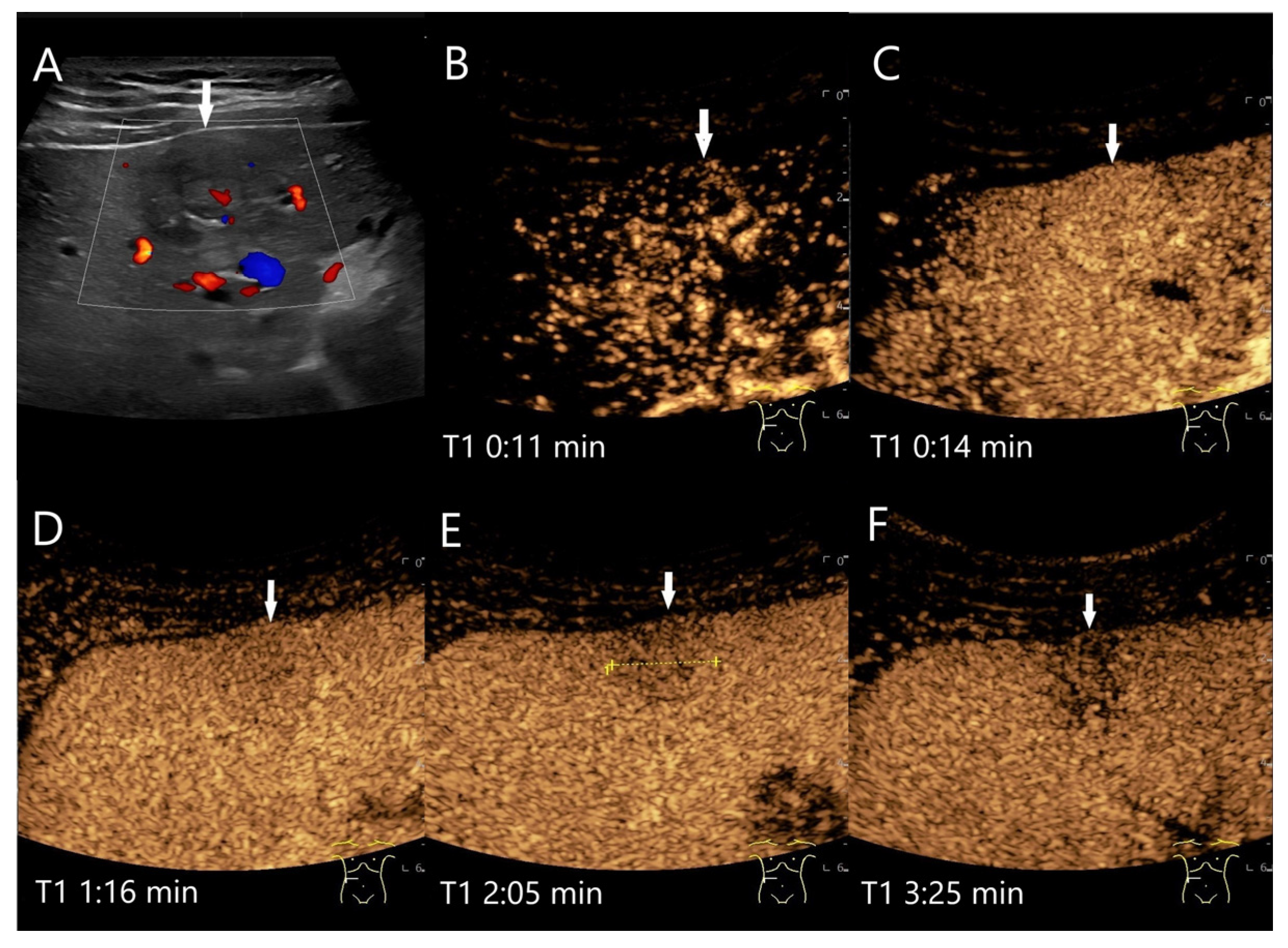 Diagnostics 15 00998 g004