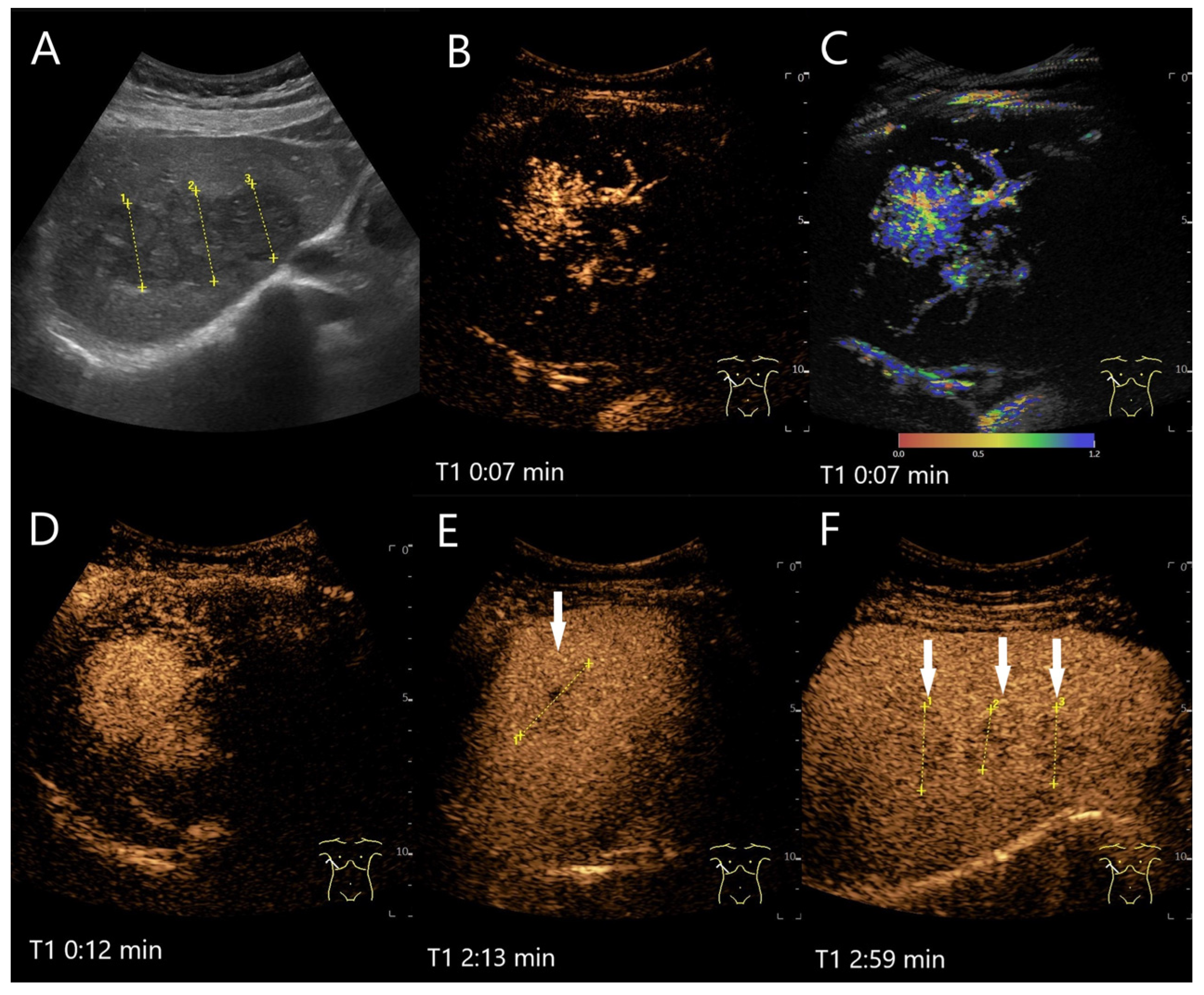 Diagnostics 15 00998 g005