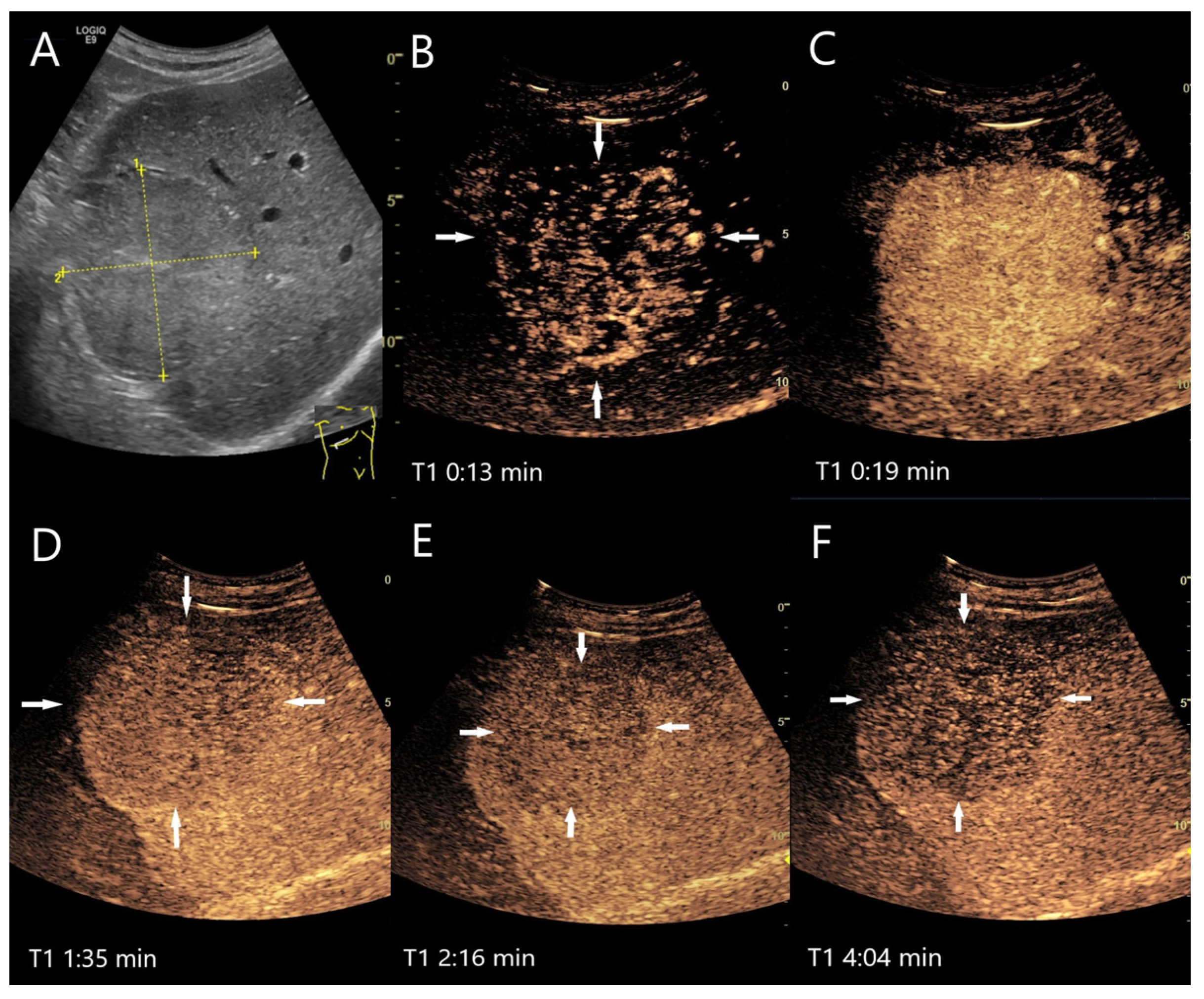 Diagnostics 15 00998 g006